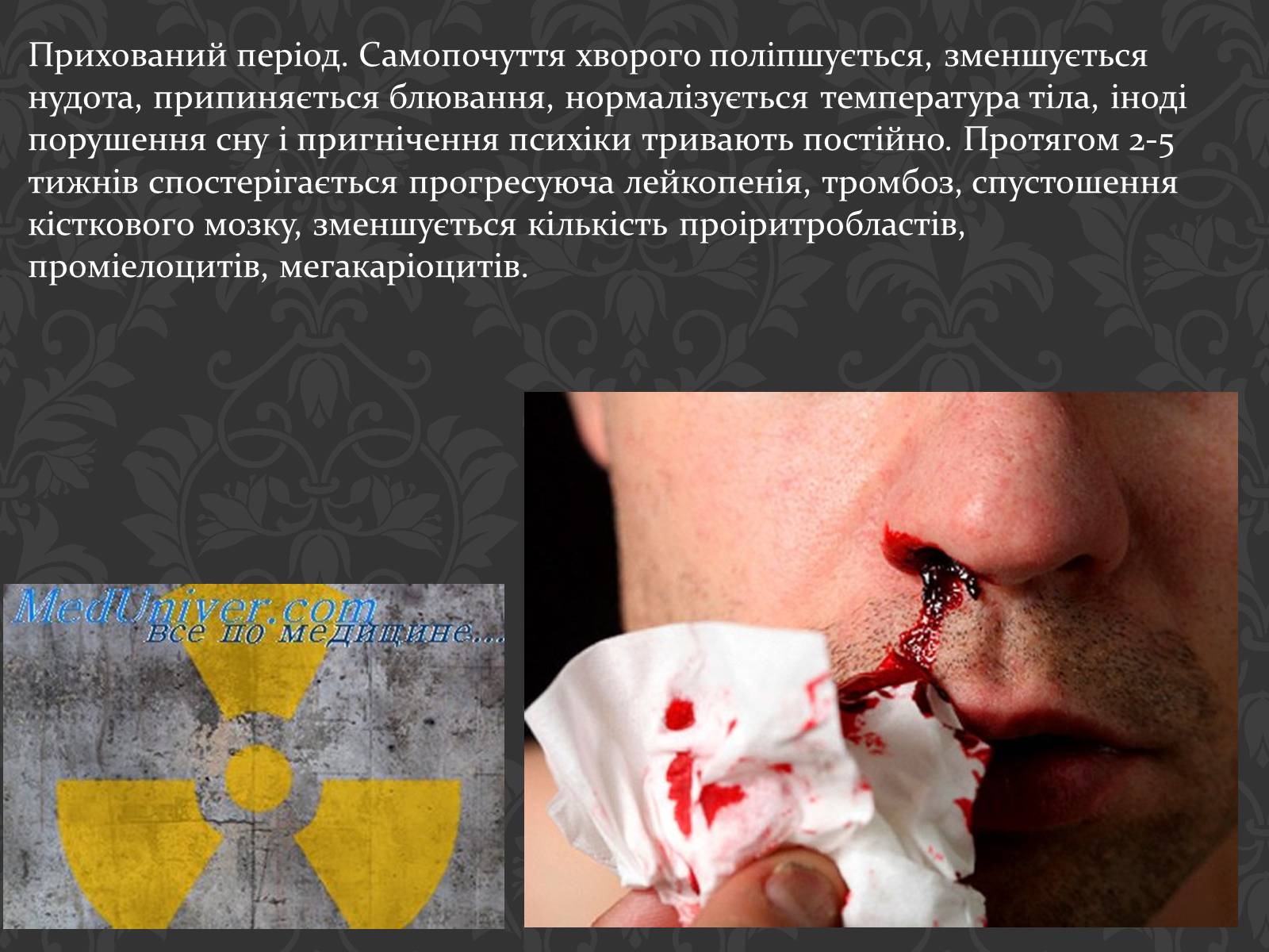 Презентація на тему «Перша медична допомога при радіаційних ураженнях» - Слайд #10 Презентація на тему «Перша медична допомога при радіаційних ураженнях» - Слайд #10