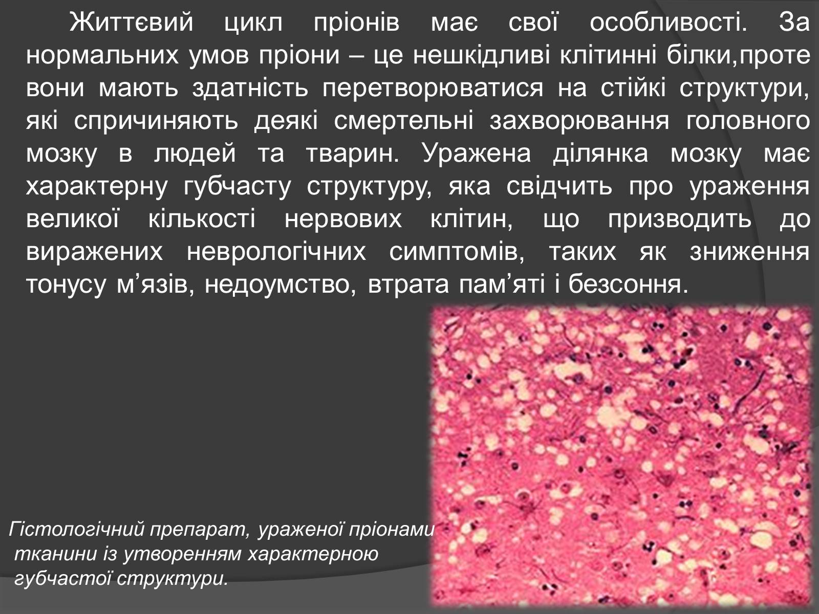 Презентація на тему «Віруси» (варіант 20) - Слайд #17 Презентація на тему «Віруси» (варіант 20) - Слайд #17