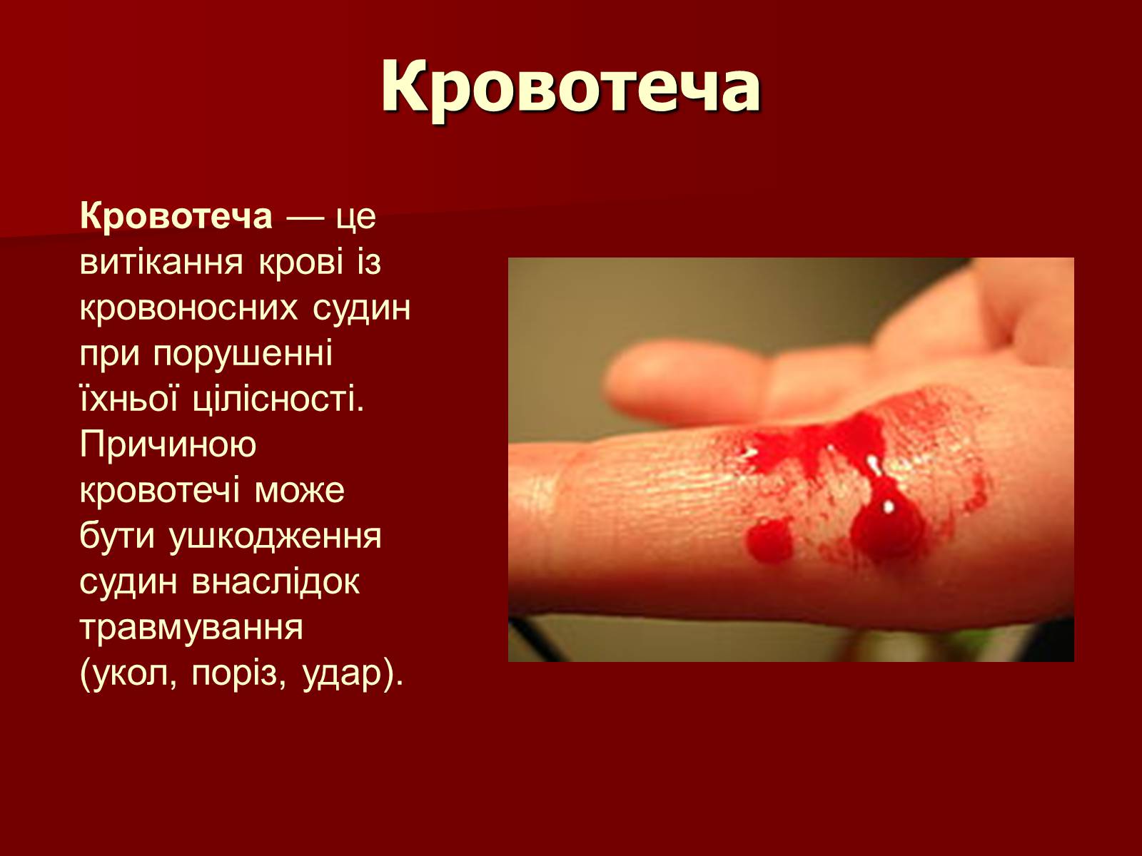 Презентація на тему «Кровотечі, їх класифікація» - Слайд #2 Презентація на тему «Кровотечі, їх класифікація» - Слайд #2