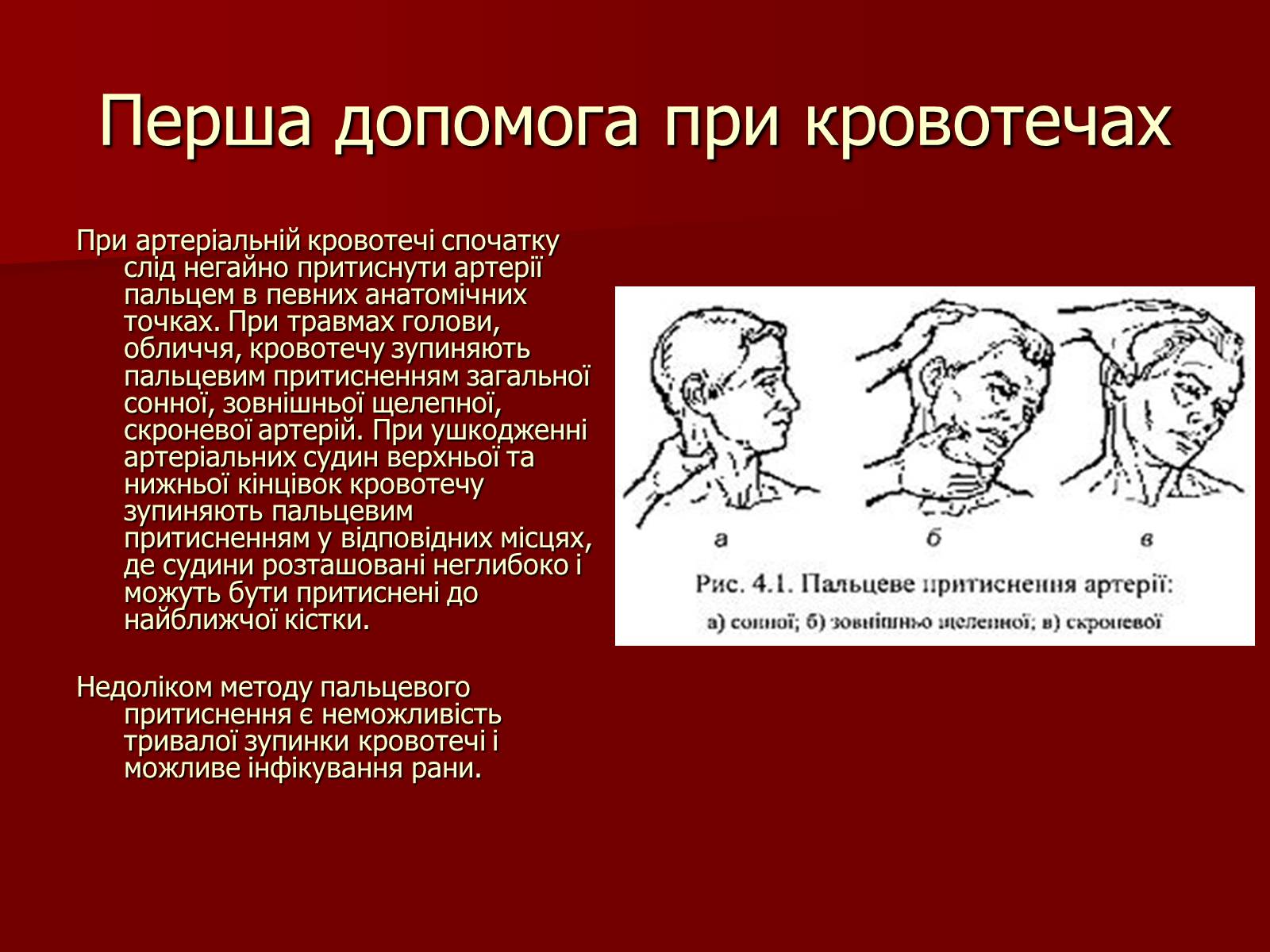Презентація на тему «Кровотечі, їх класифікація» - Слайд #9 Презентація на тему «Кровотечі, їх класифікація» - Слайд #9