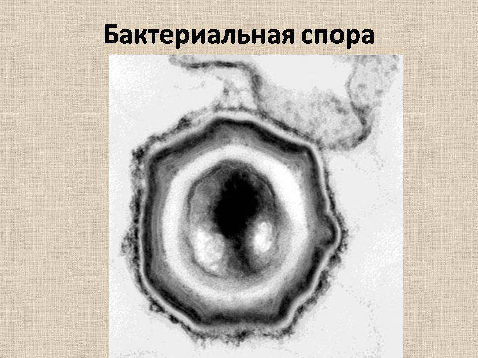 Презентація на тему «Прокариоты» (варіант 4) - Слайд #15 Презентація на тему «Прокариоты» (варіант 4) - Слайд #15