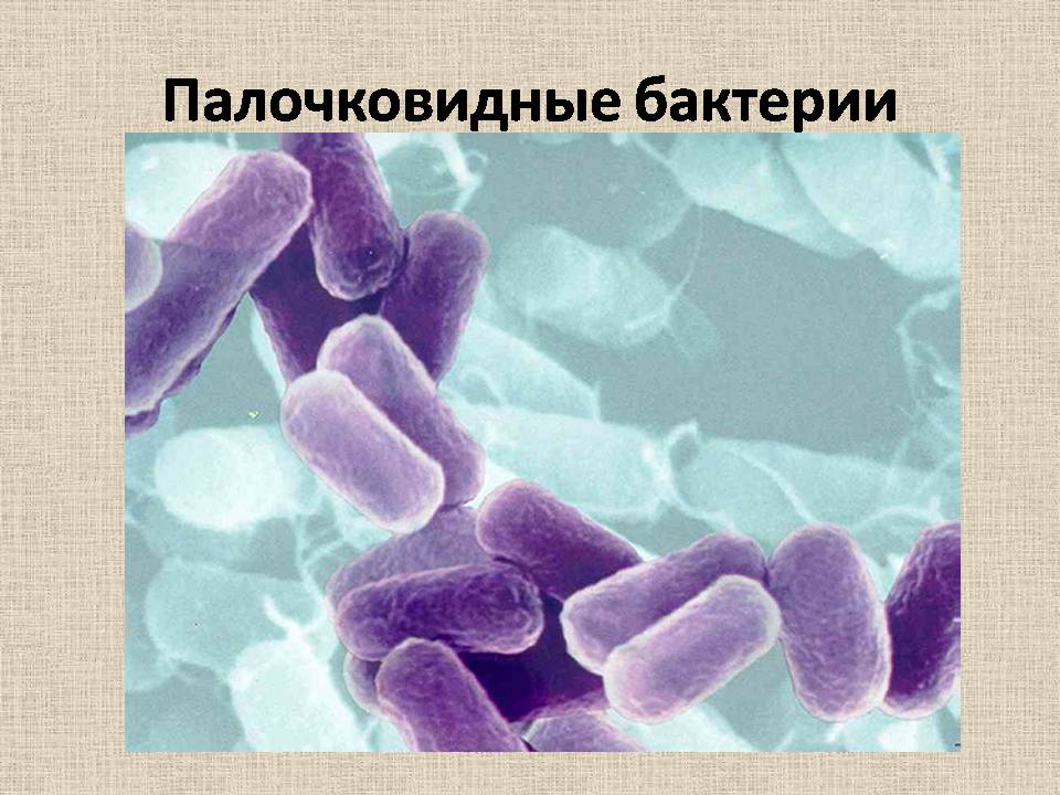 Презентація на тему «Прокариоты» (варіант 4) - Слайд #7 Презентація на тему «Прокариоты» (варіант 4) - Слайд #7