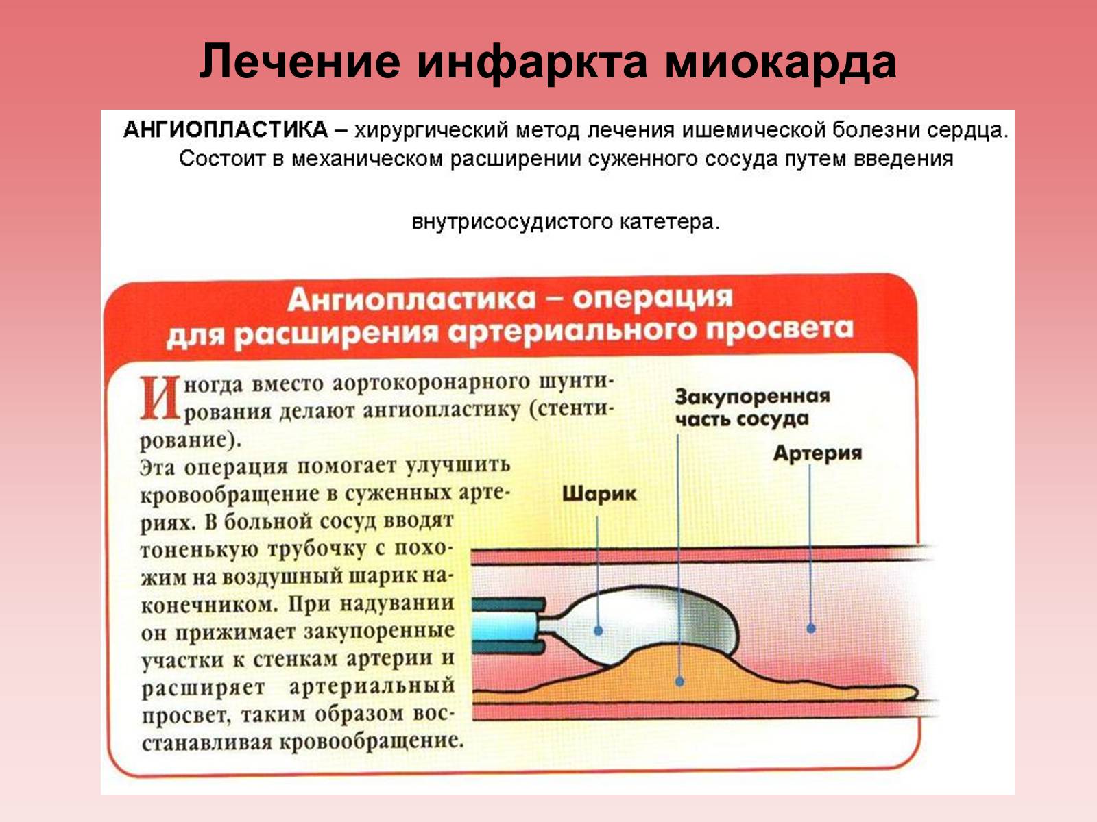 Презентація на тему «Кардиология» - Слайд #16 Презентація на тему «Кардиология» - Слайд #16