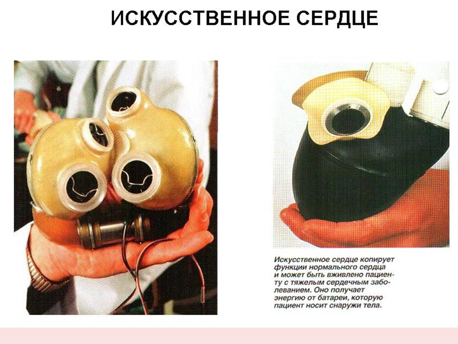 Презентація на тему «Кардиология» - Слайд #19 Презентація на тему «Кардиология» - Слайд #19