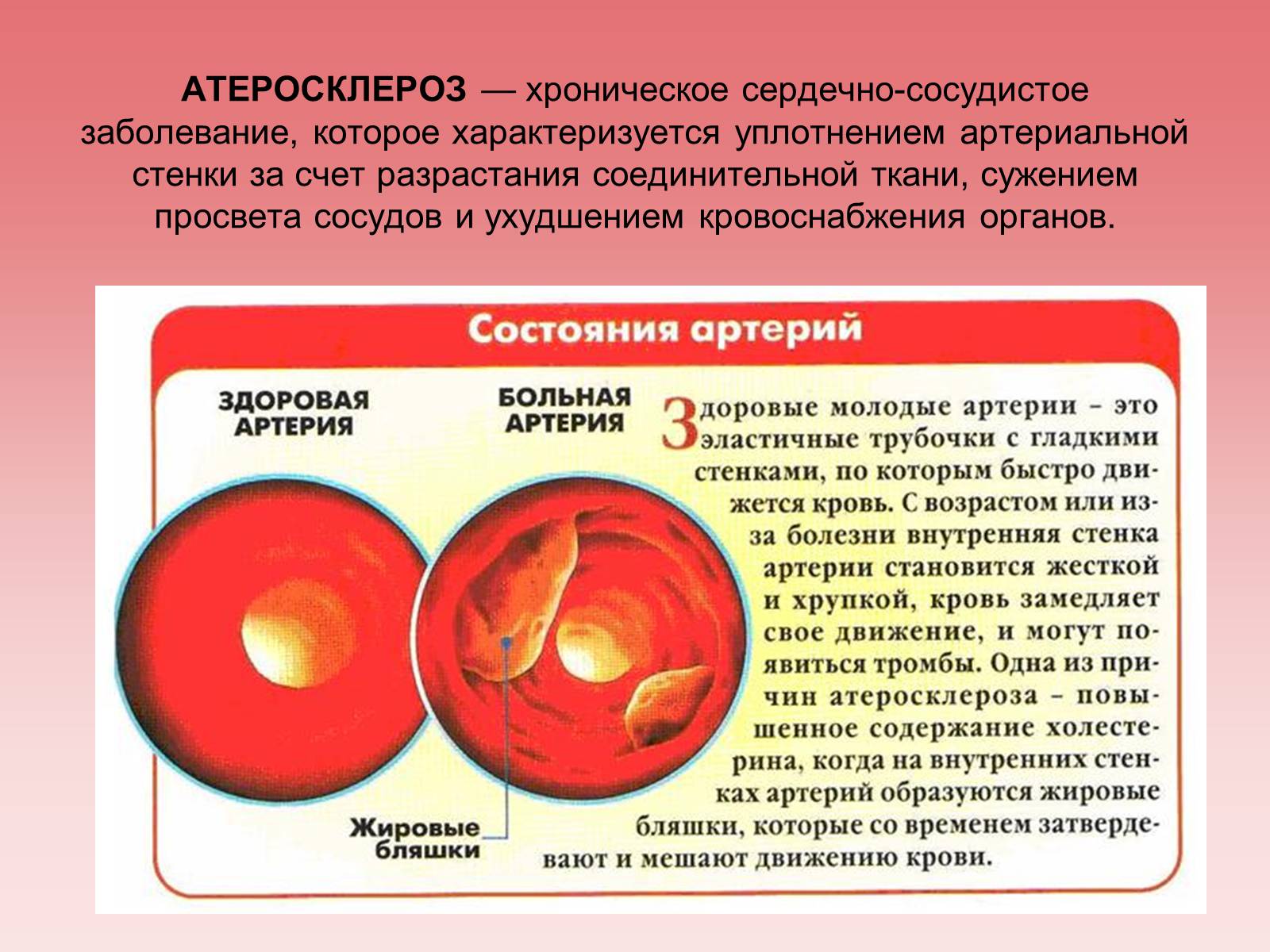 Презентація на тему «Кардиология» - Слайд #6 Презентація на тему «Кардиология» - Слайд #6