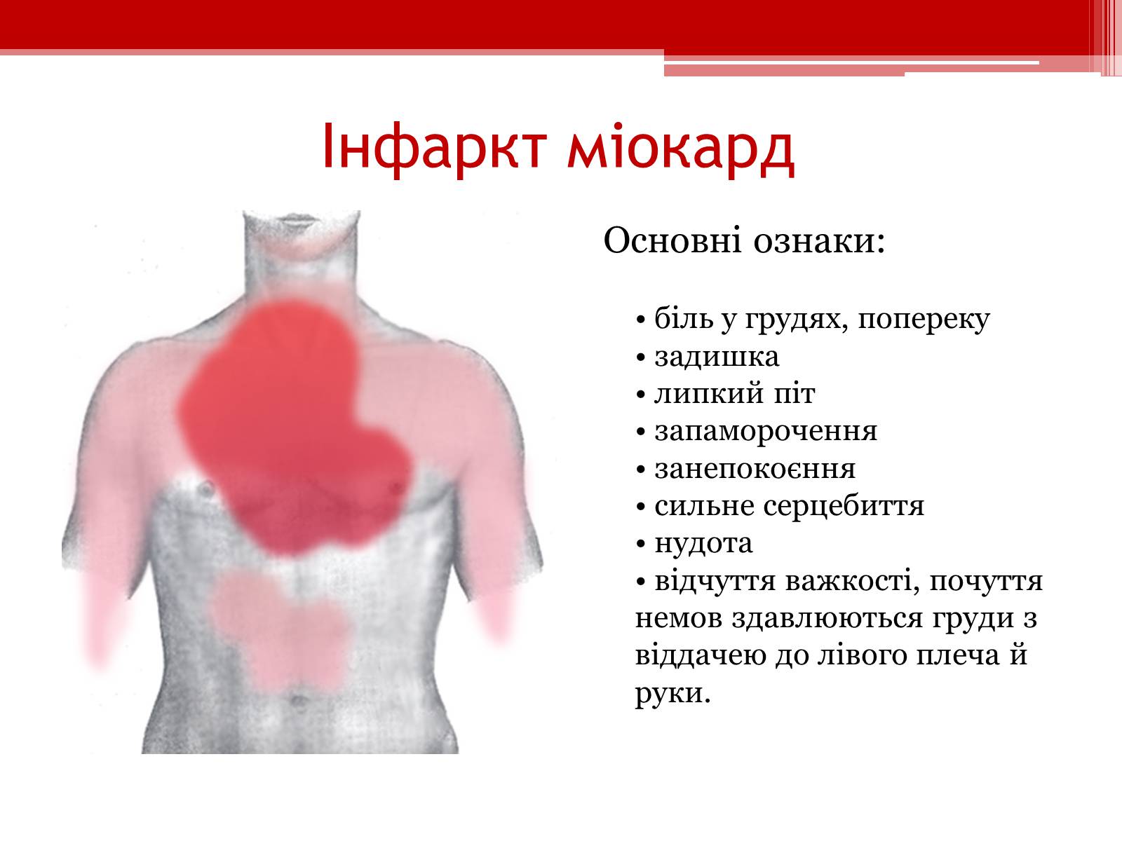 Презентація на тему «Захворювання серцево – судинної системи. Профілактика» - Слайд #7 Презентація на тему «Захворювання серцево – судинної системи. Профілактика» - Слайд #7