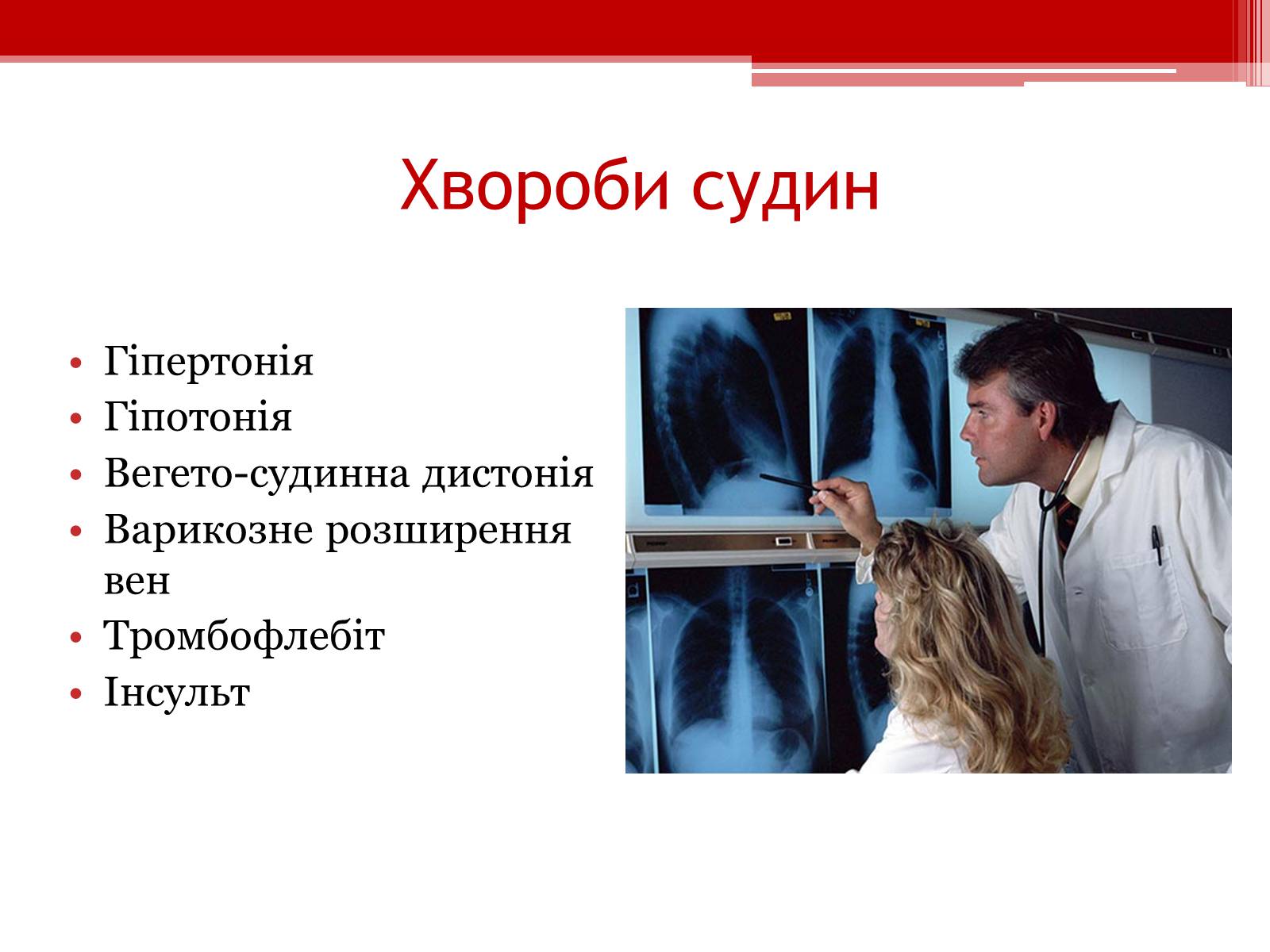Презентація на тему «Захворювання серцево – судинної системи. Профілактика» - Слайд #8 Презентація на тему «Захворювання серцево – судинної системи. Профілактика» - Слайд #8