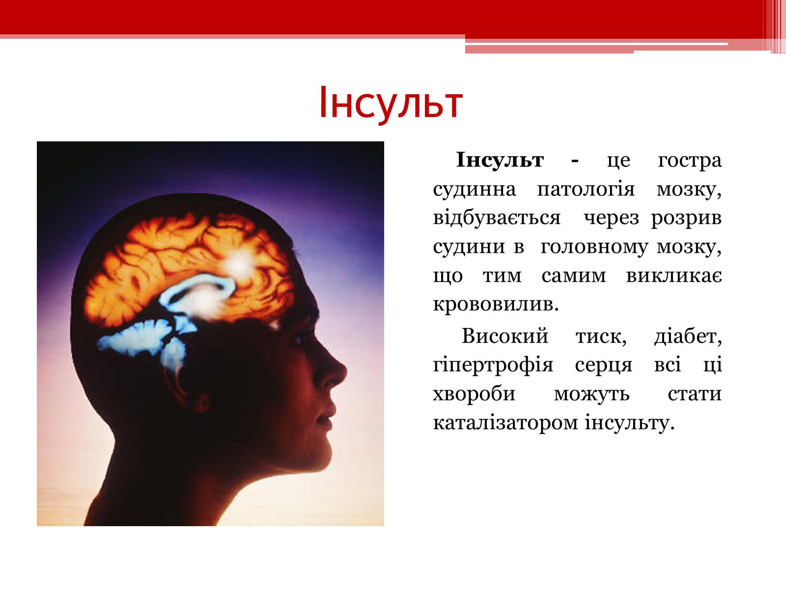 Презентація на тему «Захворювання серцево – судинної системи. Профілактика» - Слайд #9 Презентація на тему «Захворювання серцево – судинної системи. Профілактика» - Слайд #9