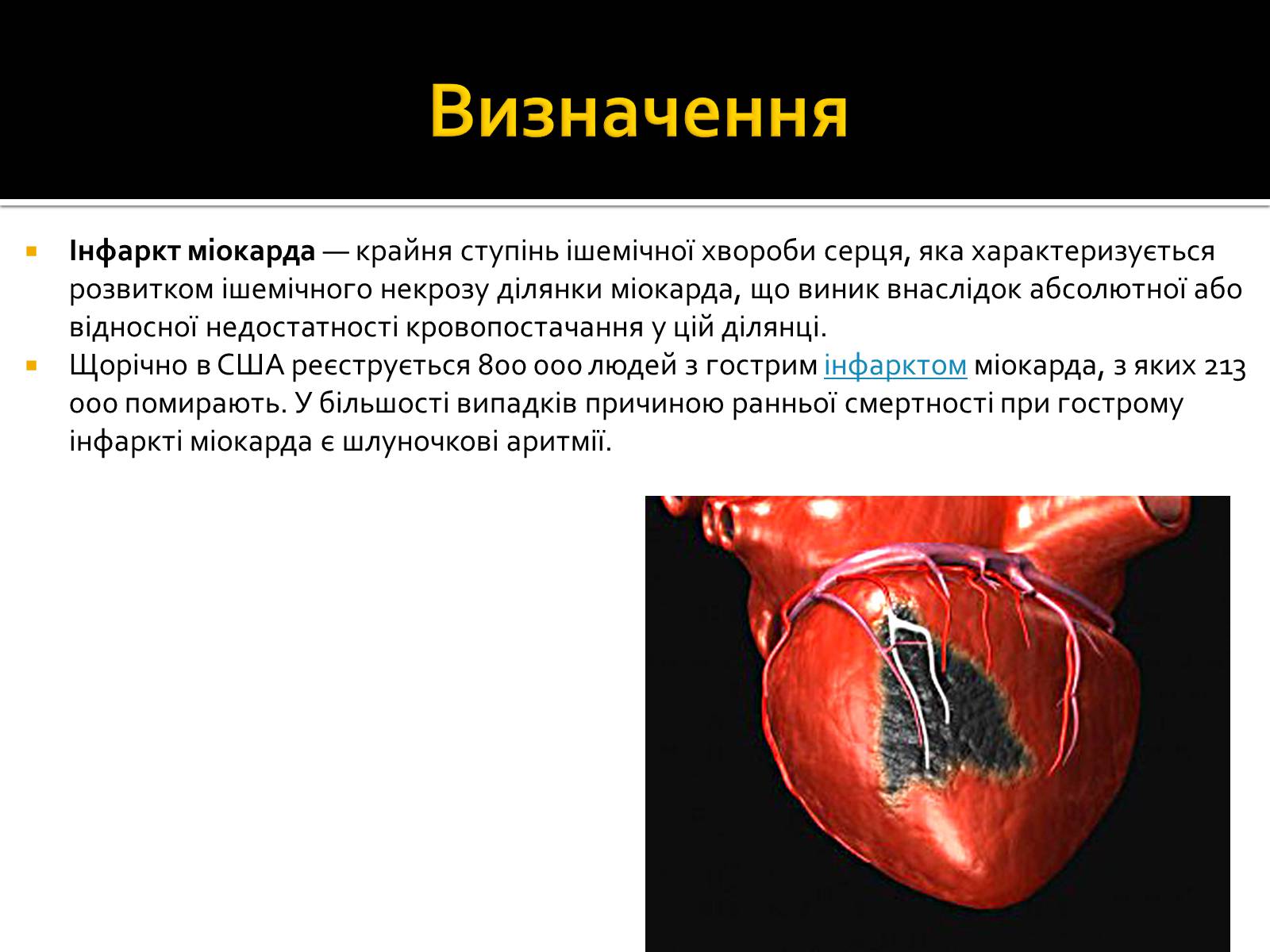 Презентація на тему «Інфаркт міокарда» (варіант 1) - Слайд #2 Презентація на тему «Інфаркт міокарда» (варіант 1) - Слайд #2