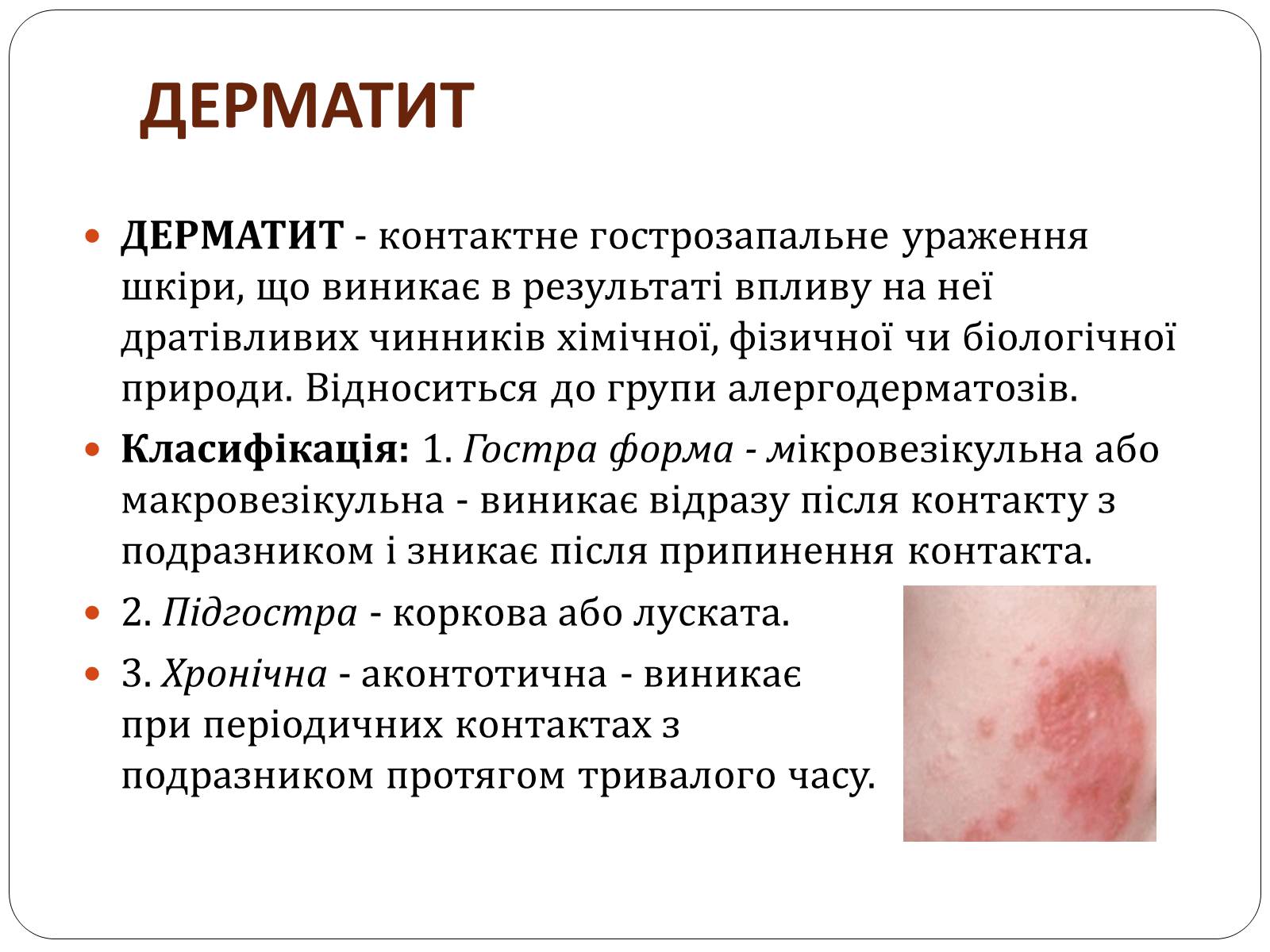 Презентація на тему «Захворювання шкіри» (варіант 3) - Слайд #2 Презентація на тему «Захворювання шкіри» (варіант 3) - Слайд #2