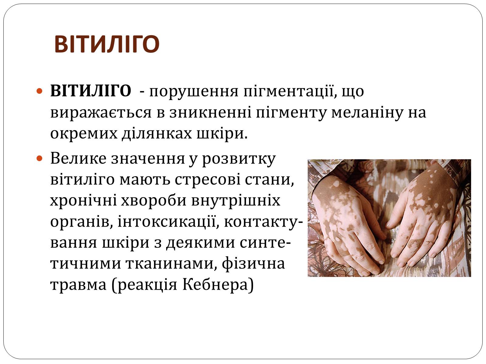 Презентація на тему «Захворювання шкіри» (варіант 3) - Слайд #3 Презентація на тему «Захворювання шкіри» (варіант 3) - Слайд #3