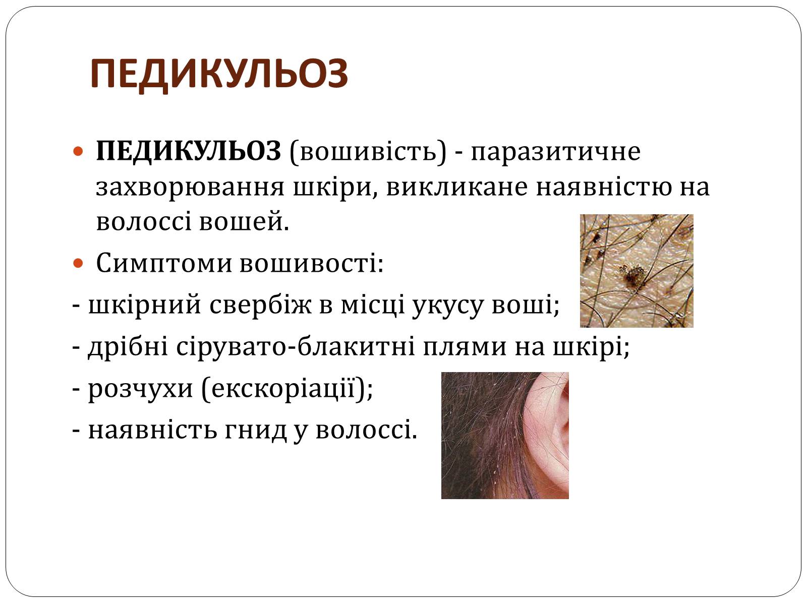 Презентація на тему «Захворювання шкіри» (варіант 3) - Слайд #5 Презентація на тему «Захворювання шкіри» (варіант 3) - Слайд #5