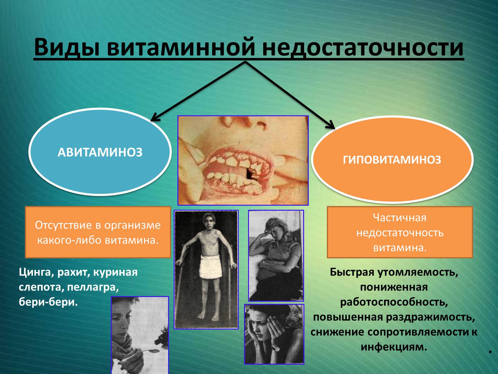 Презентація на тему «Витамины» (варіант 1) - Слайд #15 Презентація на тему «Витамины» (варіант 1) - Слайд #15