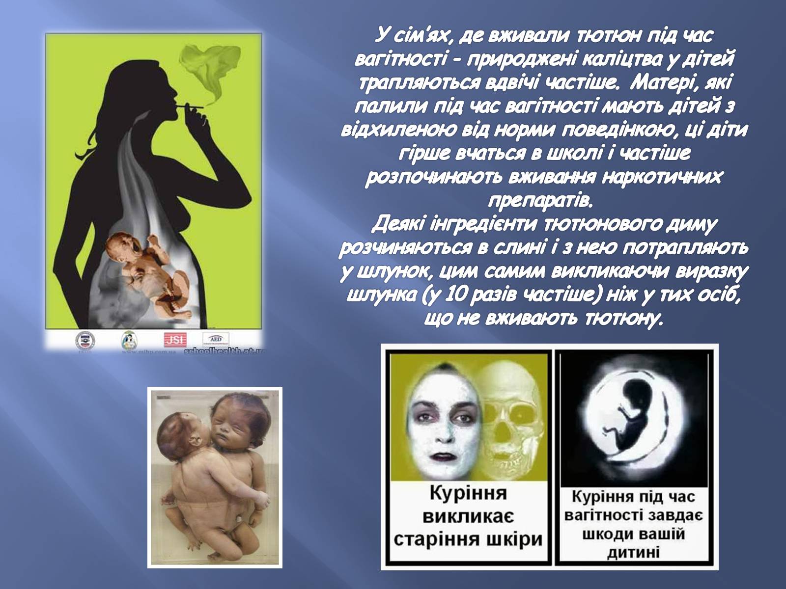 Презентація на тему «Тютюнопаління» (варіант 3) - Слайд #10 Презентація на тему «Тютюнопаління» (варіант 3) - Слайд #10