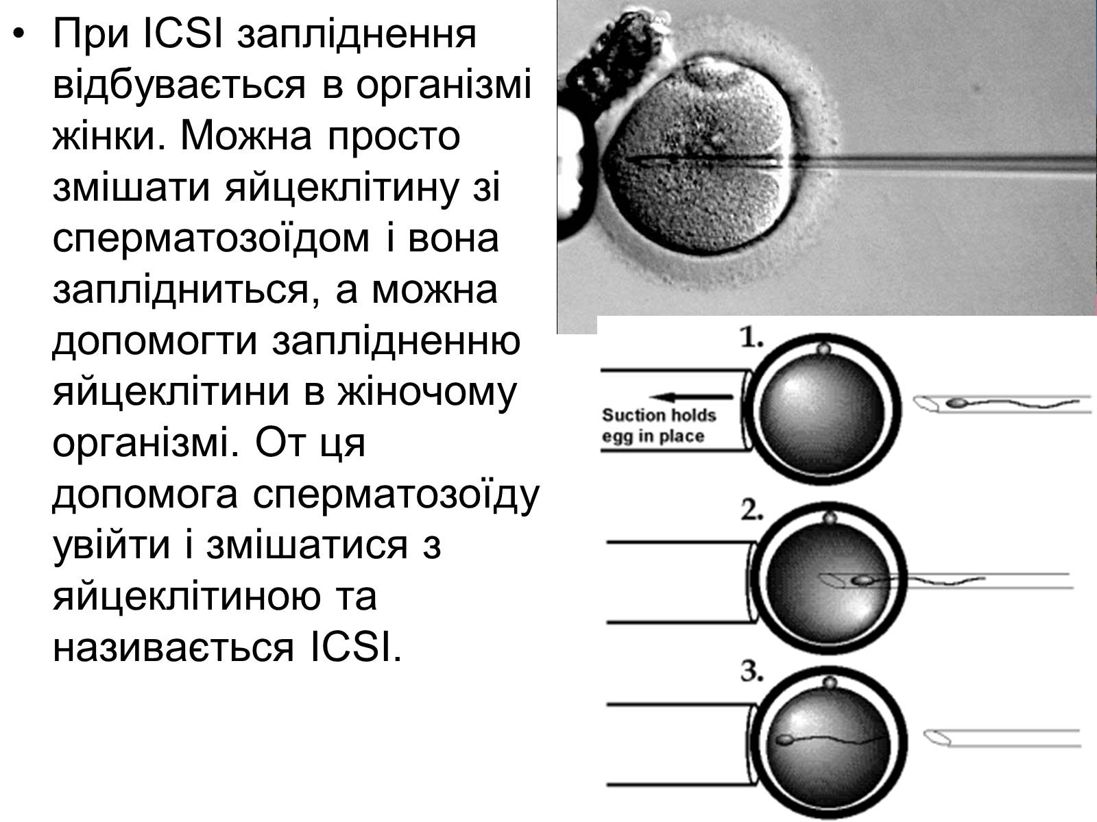 Презентація на тему «Діти з пробірки» - Слайд #7 Презентація на тему «Діти з пробірки» - Слайд #7