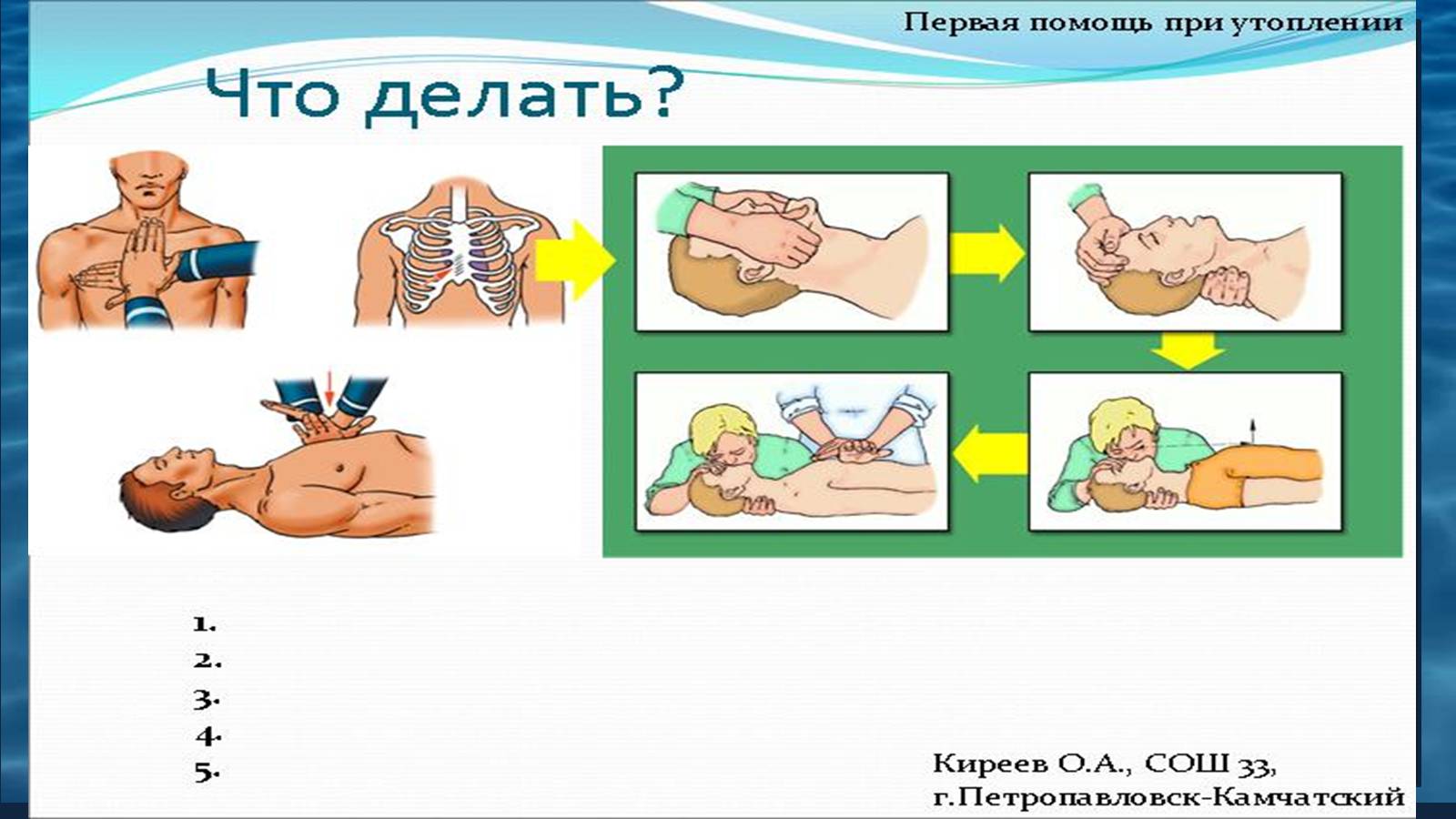 Презентація на тему «Надання першої допомоги при утопленні» - Слайд #10 Презентація на тему «Надання першої допомоги при утопленні» - Слайд #10