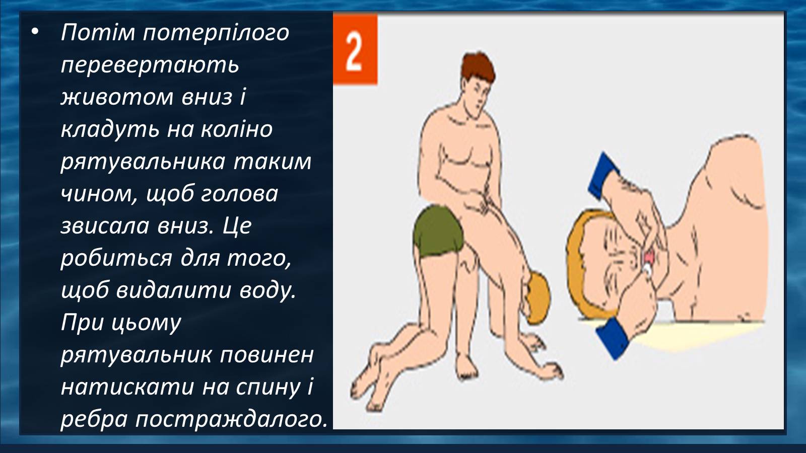 Презентація на тему «Надання першої допомоги при утопленні» - Слайд #7 Презентація на тему «Надання першої допомоги при утопленні» - Слайд #7