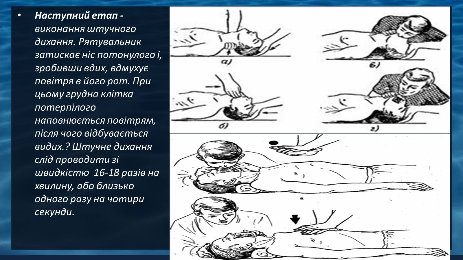 Презентація на тему «Надання першої допомоги при утопленні» - Слайд #8 Презентація на тему «Надання першої допомоги при утопленні» - Слайд #8