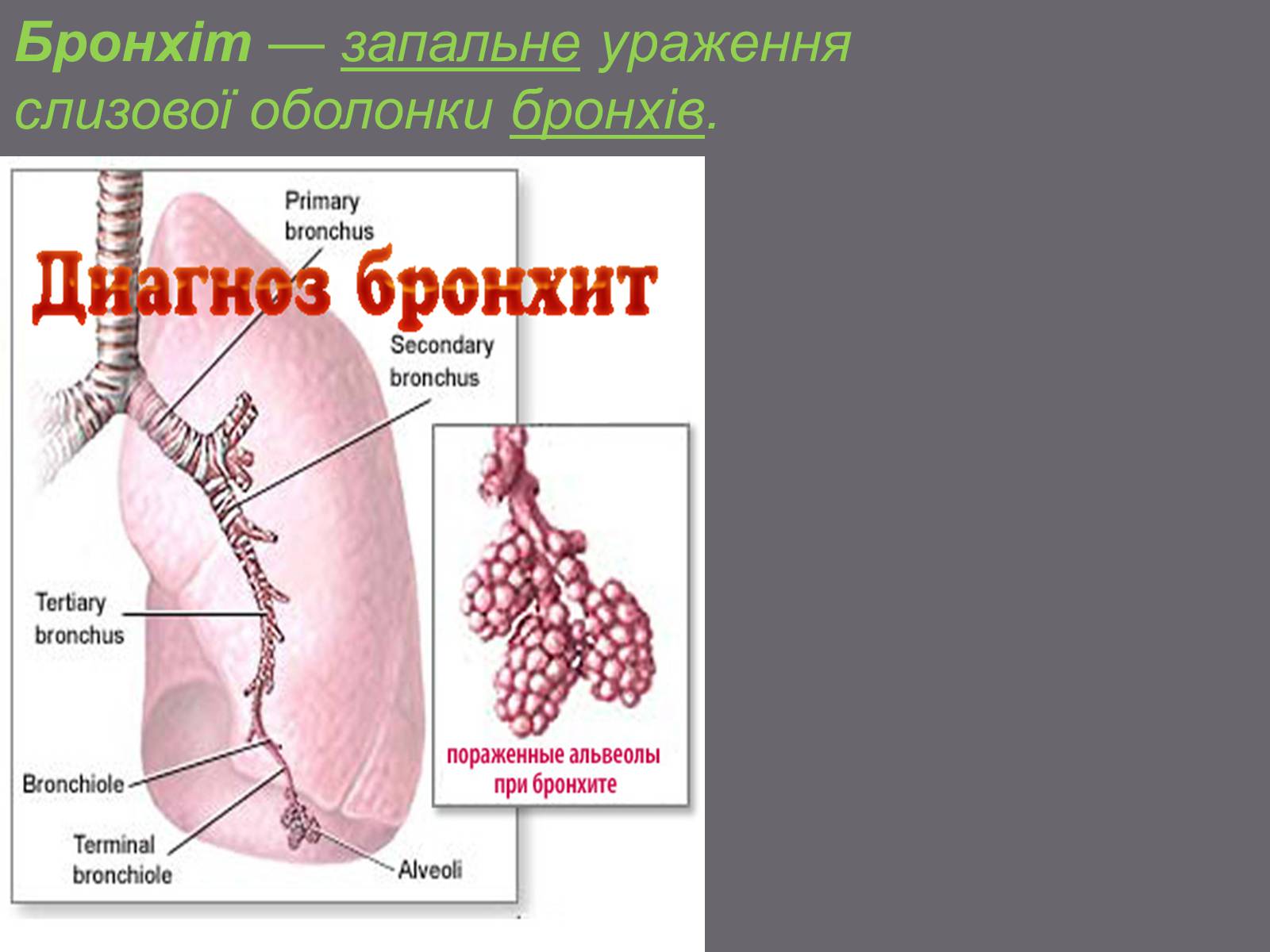 Презентація на тему «Бронхіт» - Слайд #2 Презентація на тему «Бронхіт» - Слайд #2