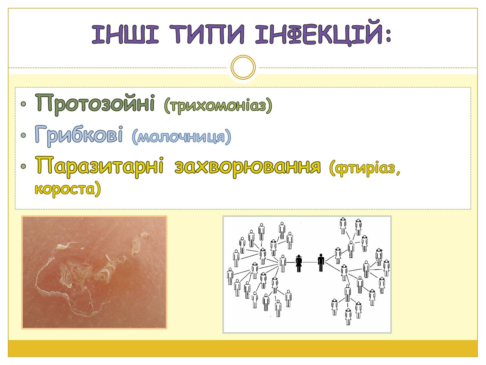 Презентація на тему «ІПСШ» - Слайд #5 Презентація на тему «ІПСШ» - Слайд #5