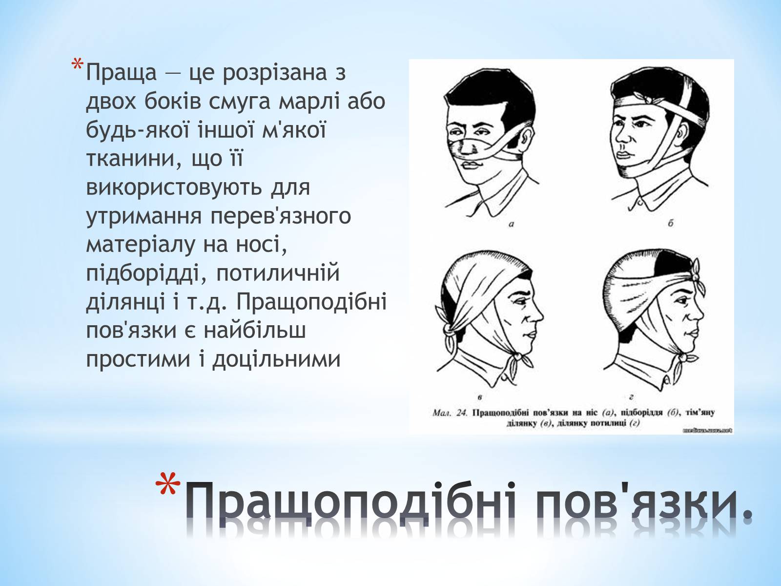 Презентація на тему «Пов’язка та її види» - Слайд #15 Презентація на тему «Пов’язка та її види» - Слайд #15