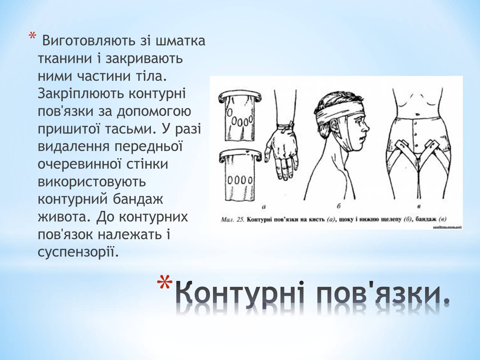 Презентація на тему «Пов’язка та її види» - Слайд #16 Презентація на тему «Пов’язка та її види» - Слайд #16