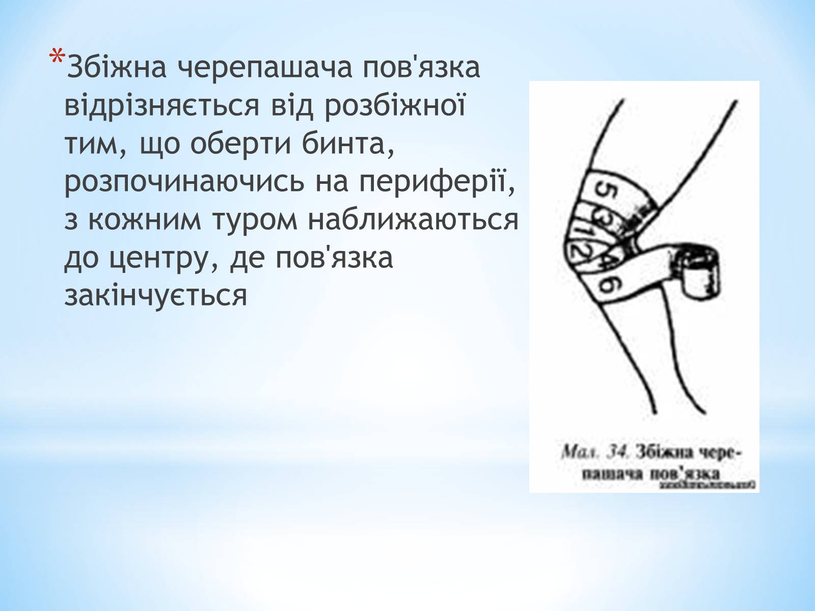 Презентація на тему «Пов’язка та її види» - Слайд #30 Презентація на тему «Пов’язка та її види» - Слайд #30