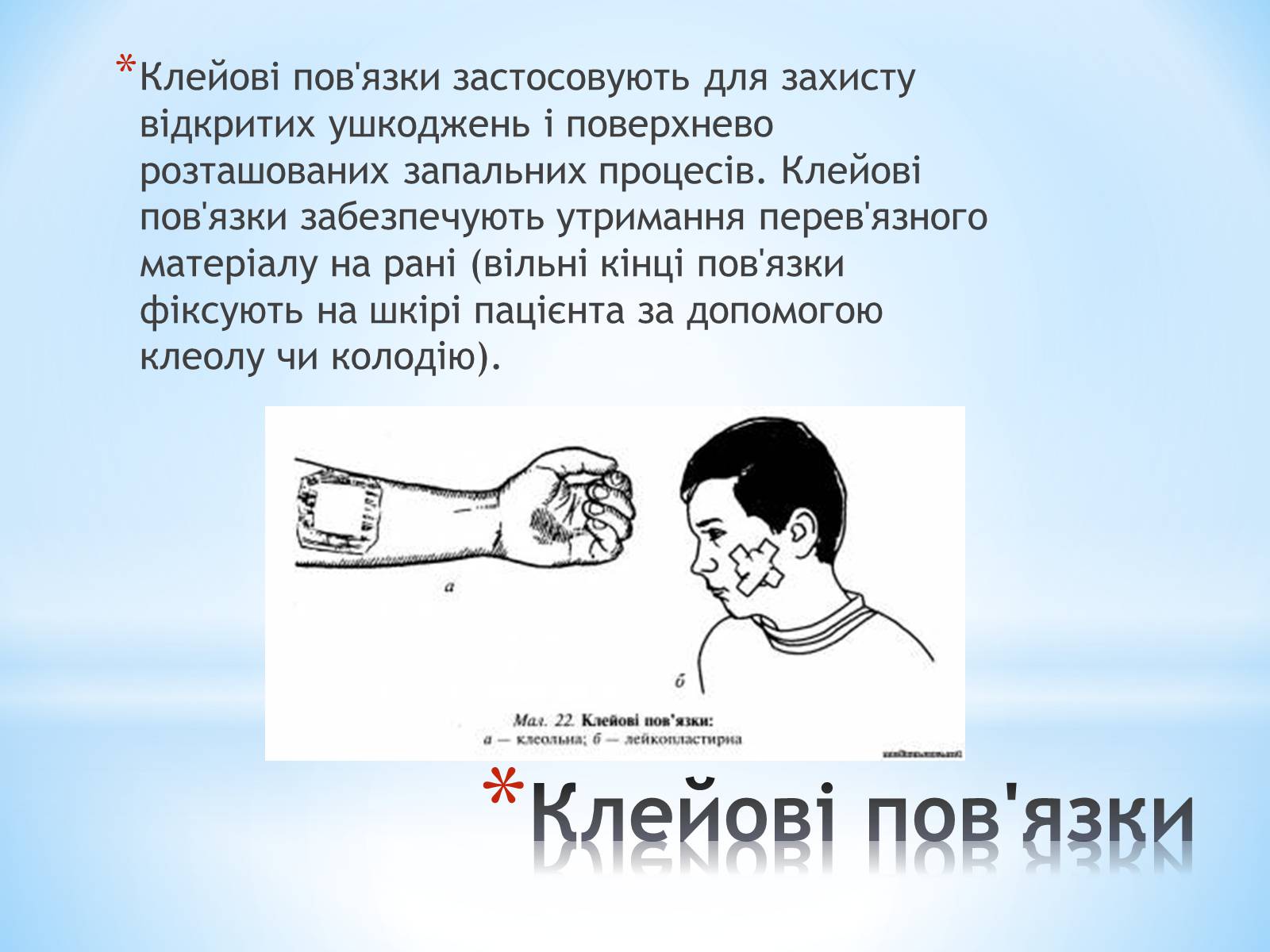 Презентація на тему «Пов’язка та її види» - Слайд #9 Презентація на тему «Пов’язка та її види» - Слайд #9