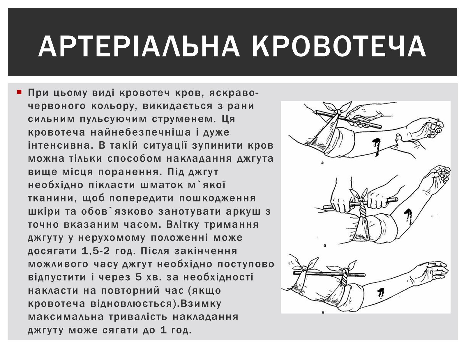 Презентація на тему «Технічна зупинка кровотечі» - Слайд #5 Презентація на тему «Технічна зупинка кровотечі» - Слайд #5
