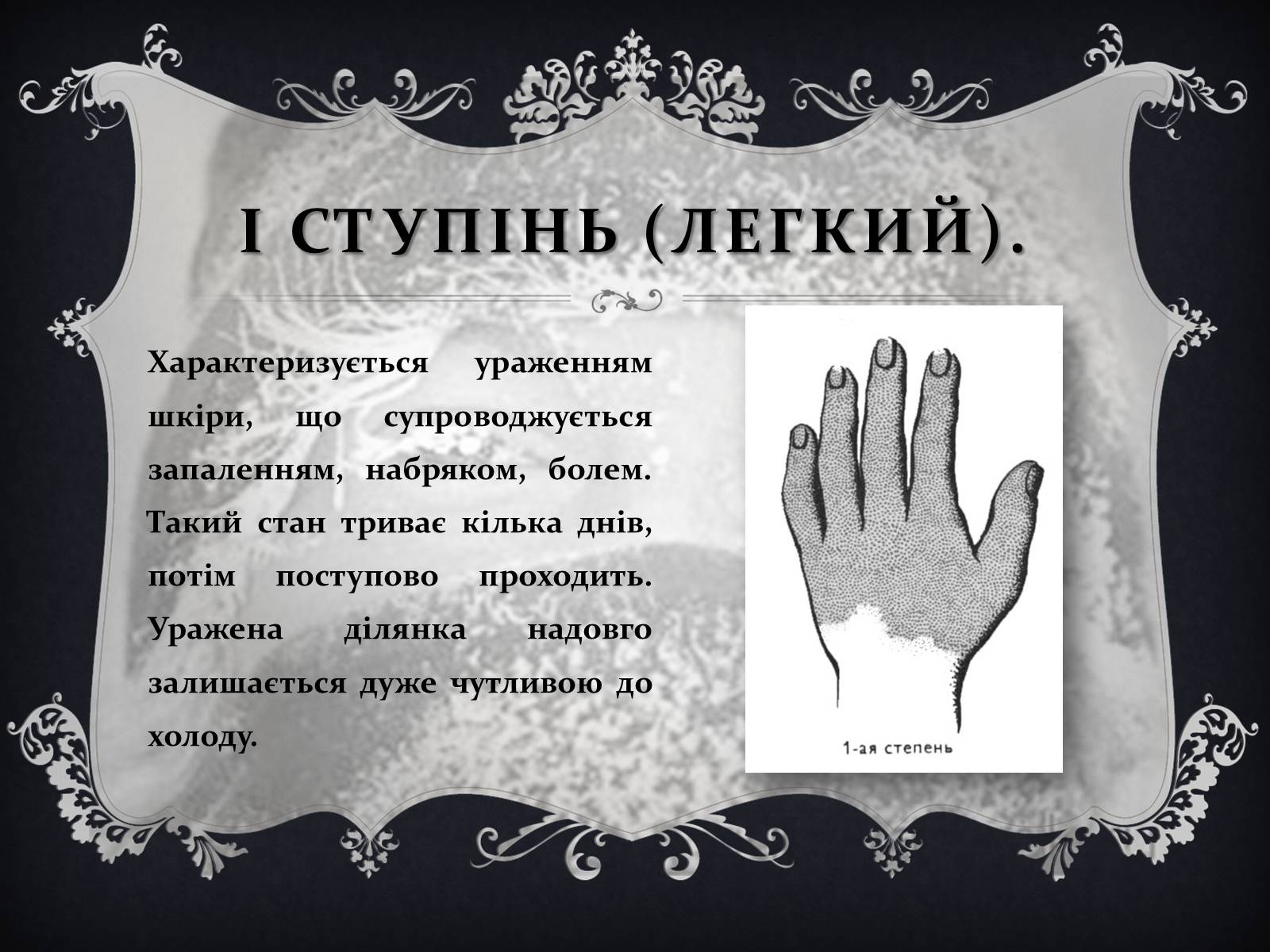 Презентація на тему «Обмороження» (варіант 1) - Слайд #11 Презентація на тему «Обмороження» (варіант 1) - Слайд #11
