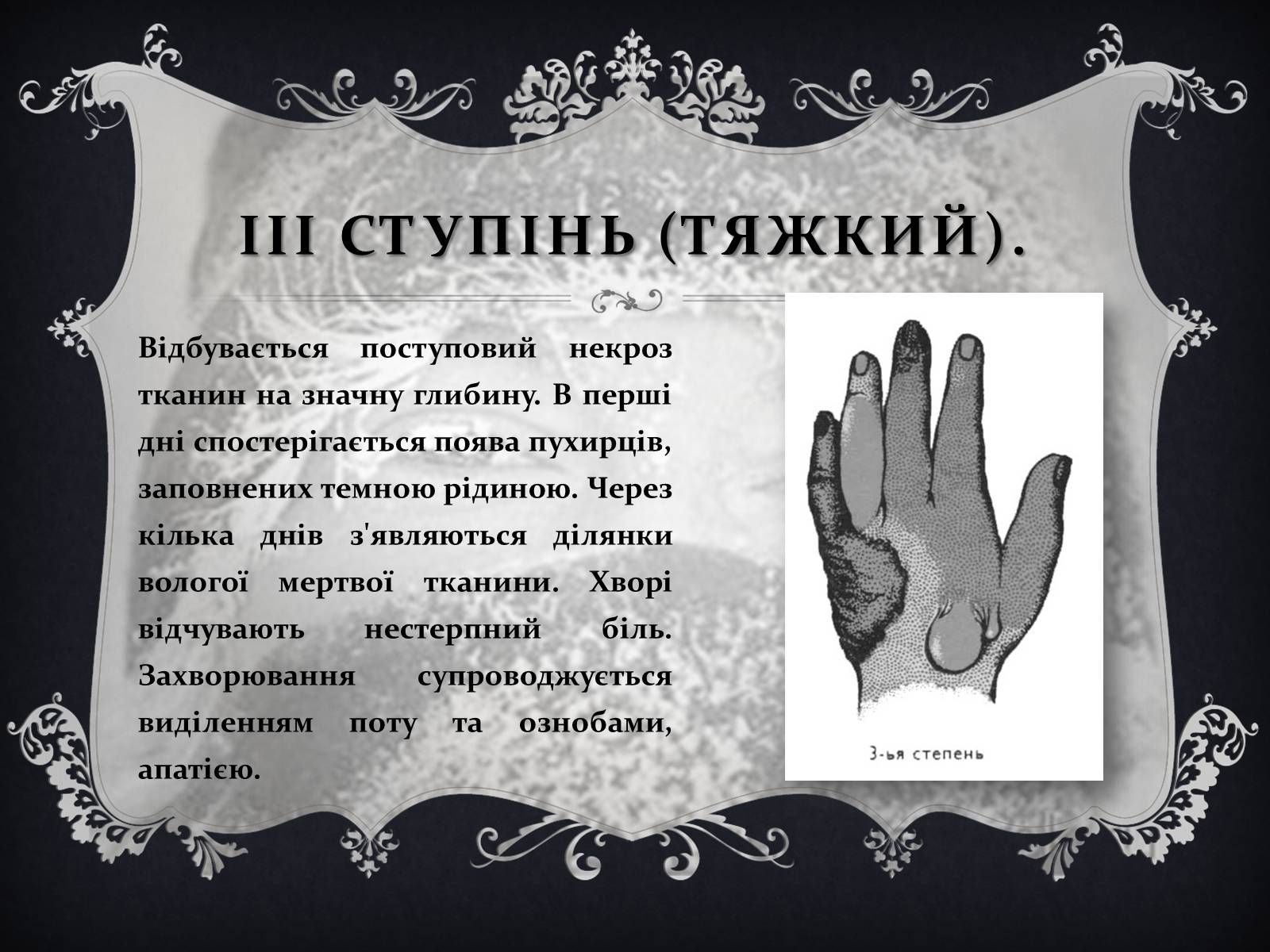 Презентація на тему «Обмороження» (варіант 1) - Слайд #13 Презентація на тему «Обмороження» (варіант 1) - Слайд #13
