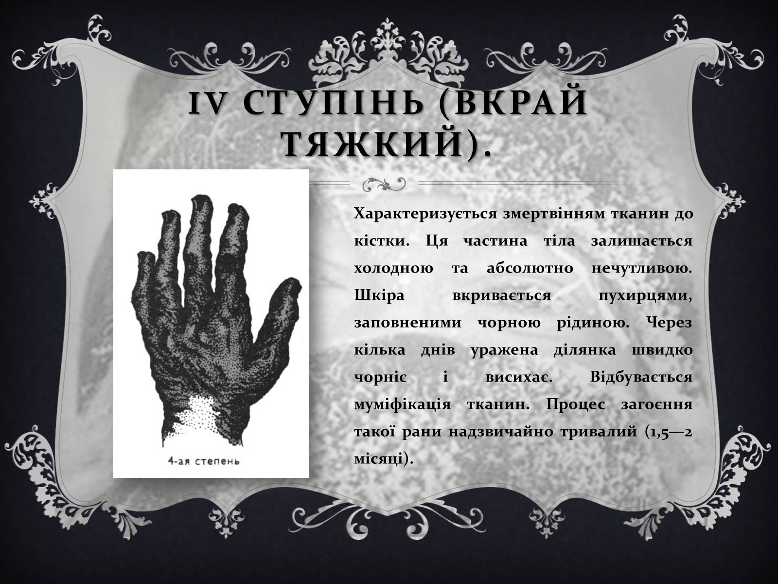 Презентація на тему «Обмороження» (варіант 1) - Слайд #14 Презентація на тему «Обмороження» (варіант 1) - Слайд #14