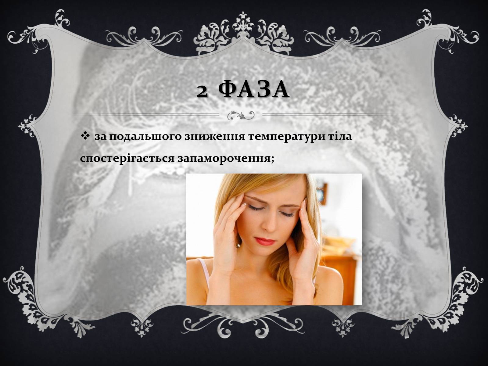 Презентація на тему «Обмороження» (варіант 1) - Слайд #7 Презентація на тему «Обмороження» (варіант 1) - Слайд #7