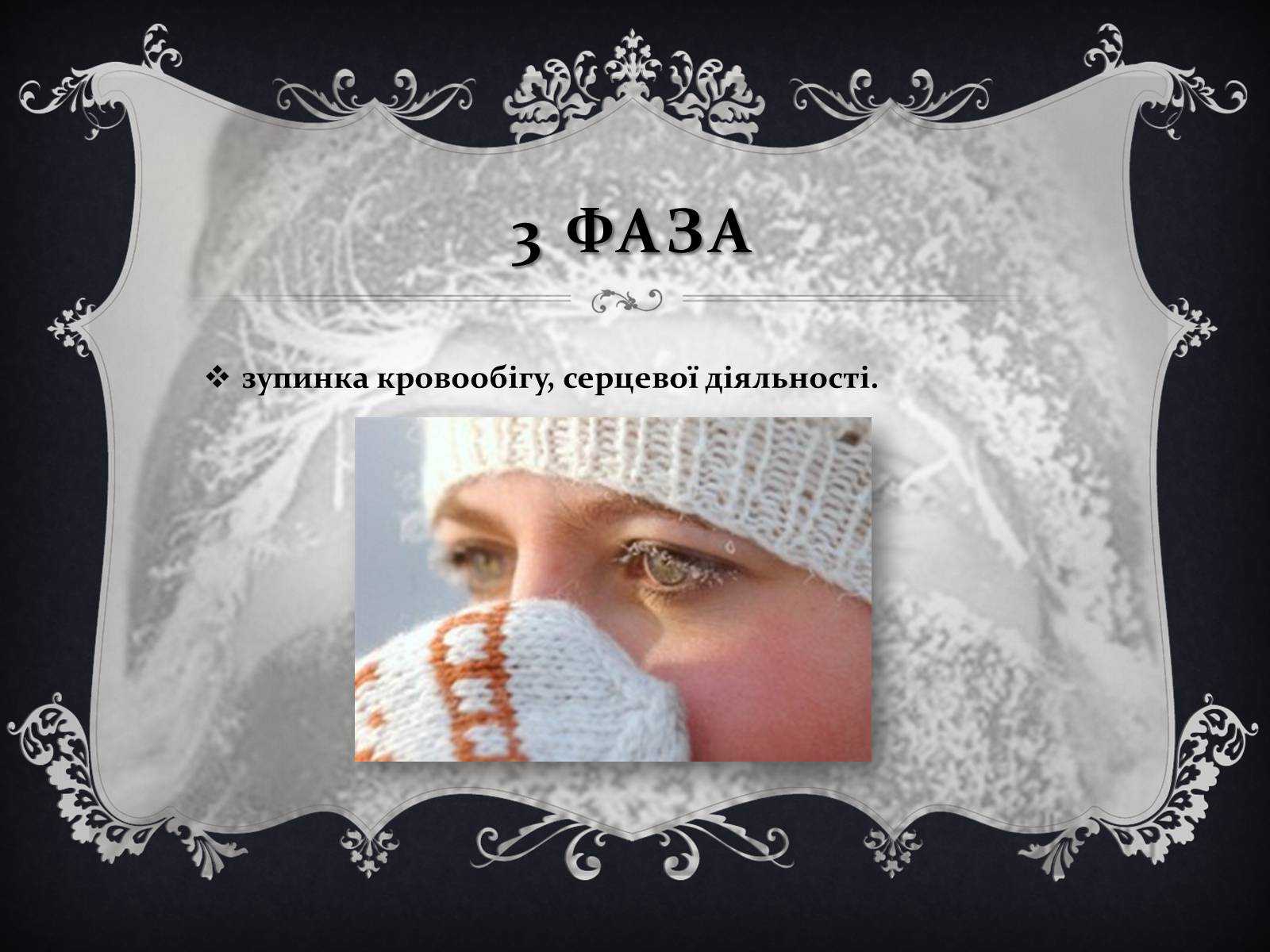 Презентація на тему «Обмороження» (варіант 1) - Слайд #8 Презентація на тему «Обмороження» (варіант 1) - Слайд #8