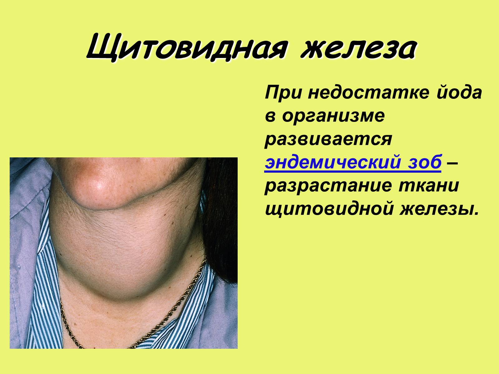 Презентація на тему «Эндокринные железы» - Слайд #14 Презентація на тему «Эндокринные железы» - Слайд #14