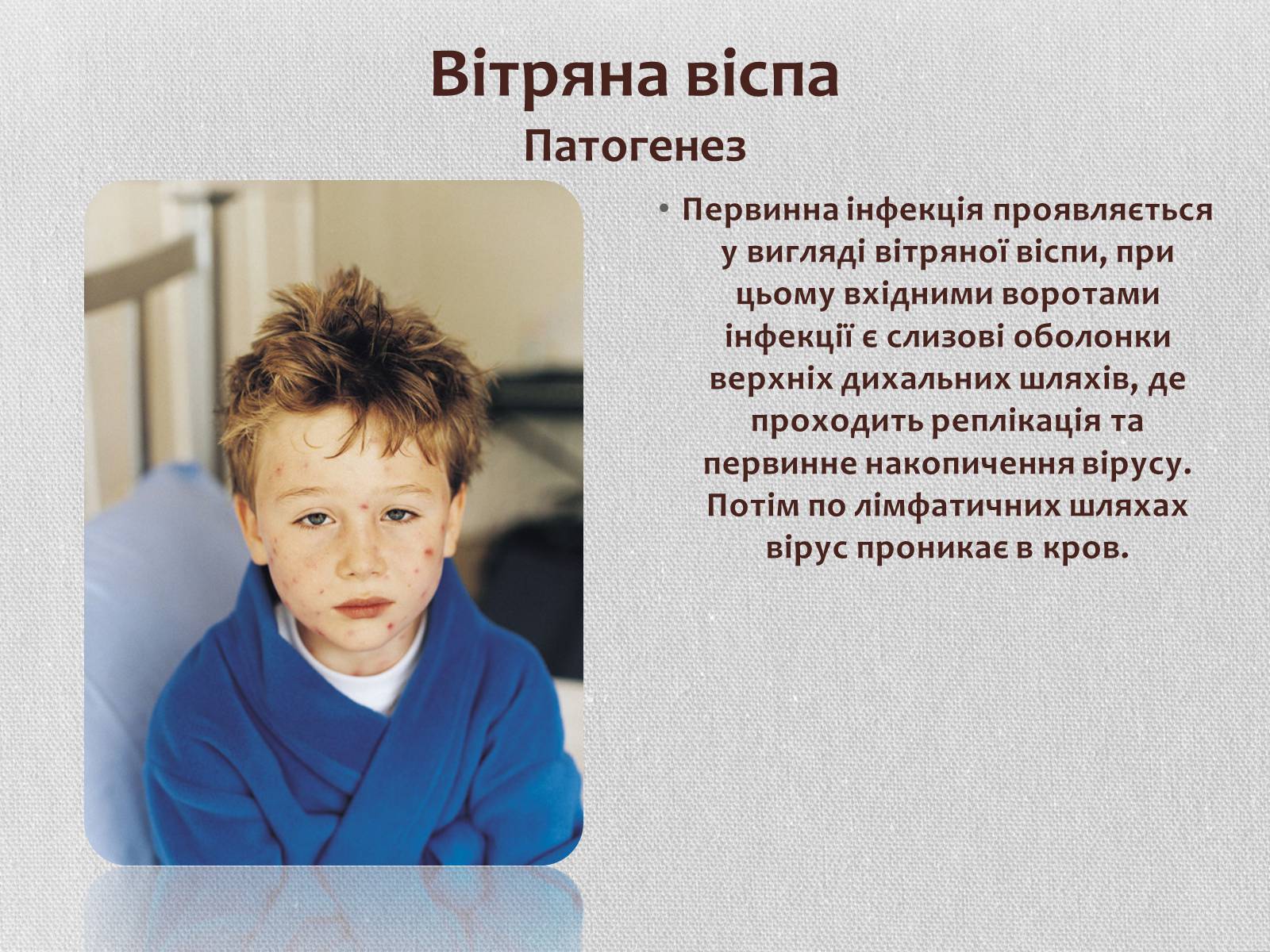 Презентація на тему «Вірус віспи» - Слайд #11 Презентація на тему «Вірус віспи» - Слайд #11