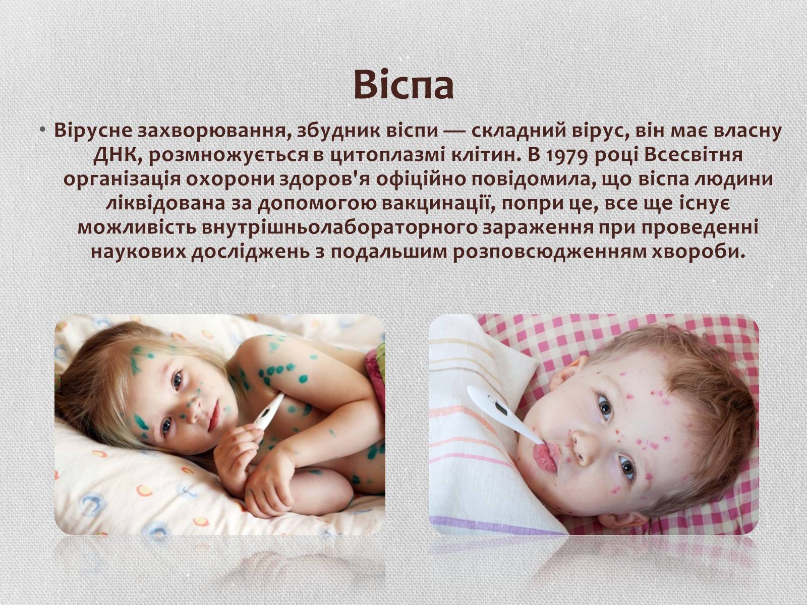 Презентація на тему «Вірус віспи» - Слайд #2 Презентація на тему «Вірус віспи» - Слайд #2