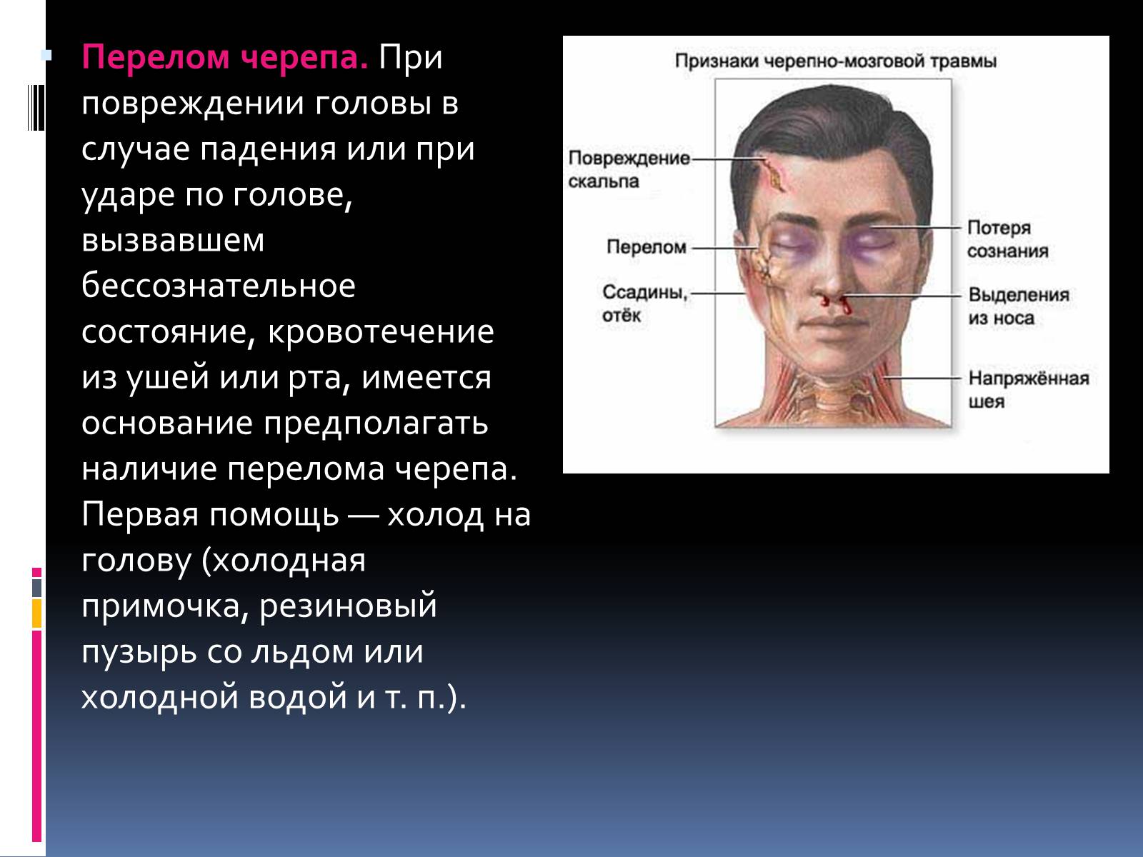 Презентація на тему «Первая помощь при переломах» (варіант 1) - Слайд #3 Презентація на тему «Первая помощь при переломах» (варіант 1) - Слайд #3