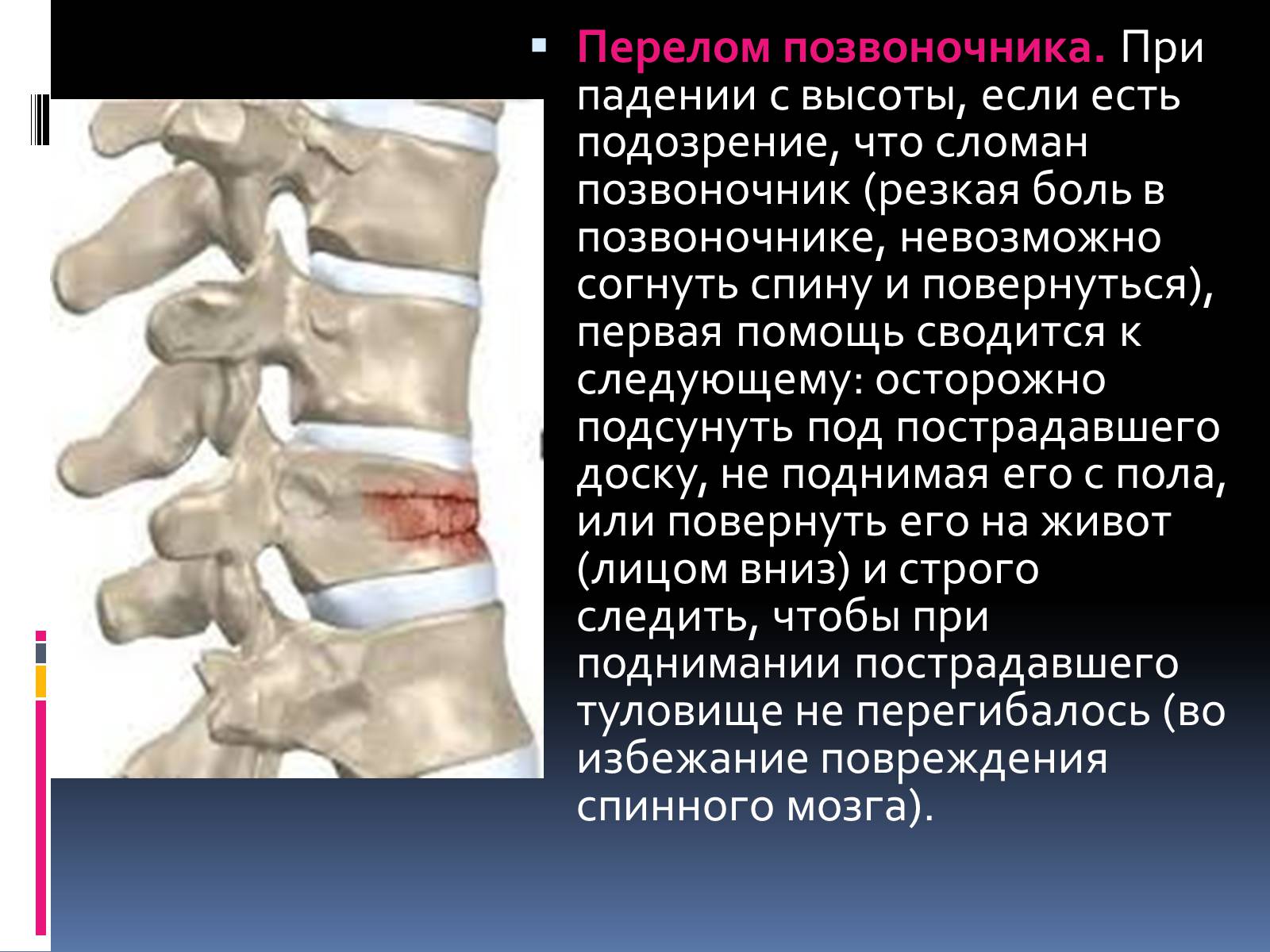 Презентація на тему «Первая помощь при переломах» (варіант 1) - Слайд #4 Презентація на тему «Первая помощь при переломах» (варіант 1) - Слайд #4