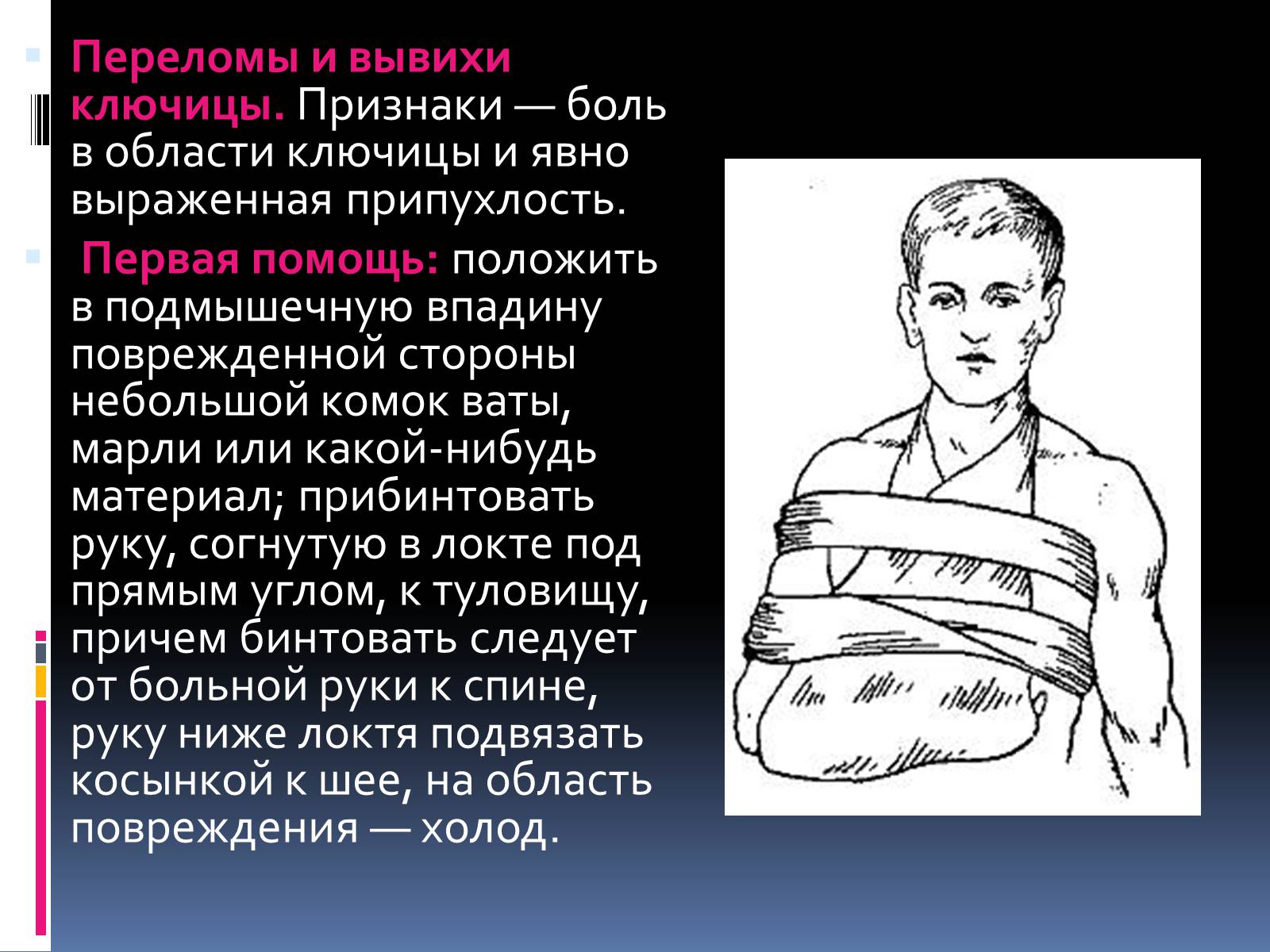 Презентація на тему «Первая помощь при переломах» (варіант 1) - Слайд #5 Презентація на тему «Первая помощь при переломах» (варіант 1) - Слайд #5