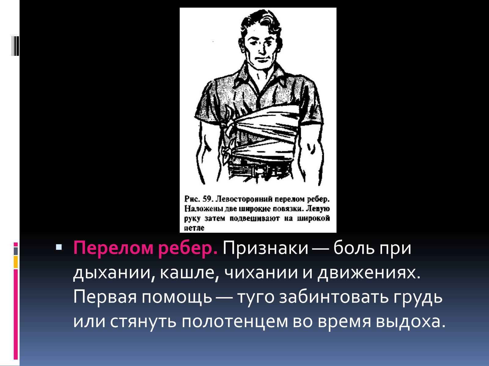 Презентація на тему «Первая помощь при переломах» (варіант 1) - Слайд #9 Презентація на тему «Первая помощь при переломах» (варіант 1) - Слайд #9