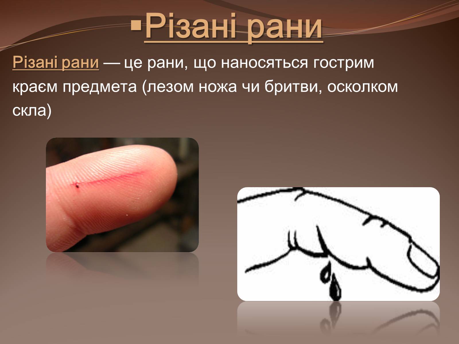Презентація на тему «Травма систем організму» (варіант 1) - Слайд #15 Презентація на тему «Травма систем організму» (варіант 1) - Слайд #15