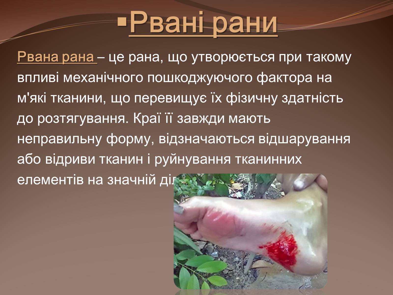 Презентація на тему «Травма систем організму» (варіант 1) - Слайд #17 Презентація на тему «Травма систем організму» (варіант 1) - Слайд #17
