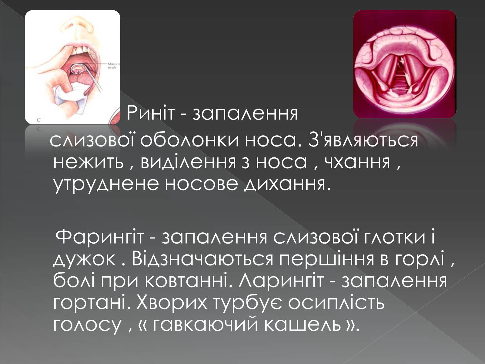 Презентація на тему «Види професійних захворювань органів дихання» - Слайд #13 Презентація на тему «Види професійних захворювань органів дихання» - Слайд #13