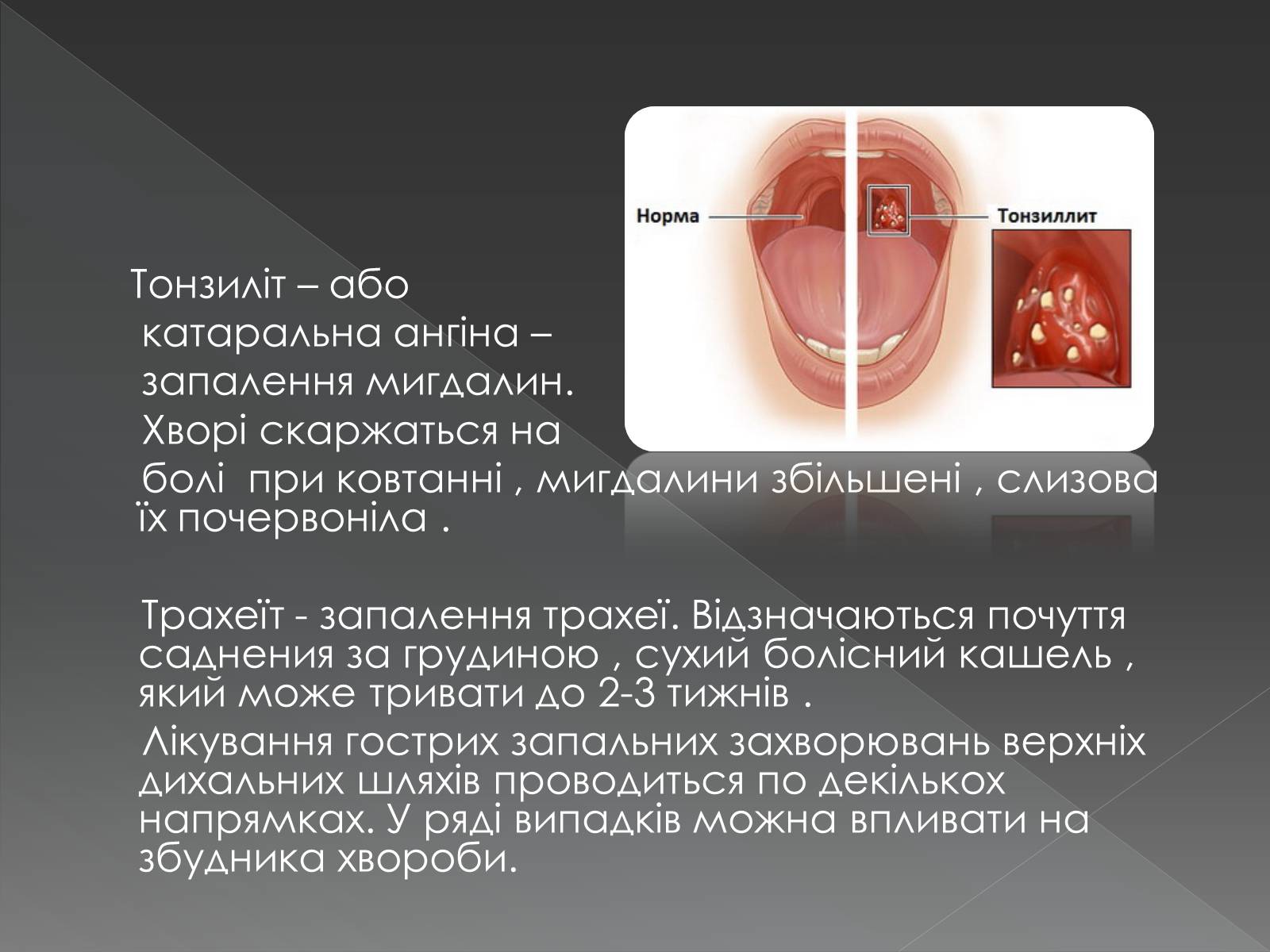 Презентація на тему «Види професійних захворювань органів дихання» - Слайд #14 Презентація на тему «Види професійних захворювань органів дихання» - Слайд #14