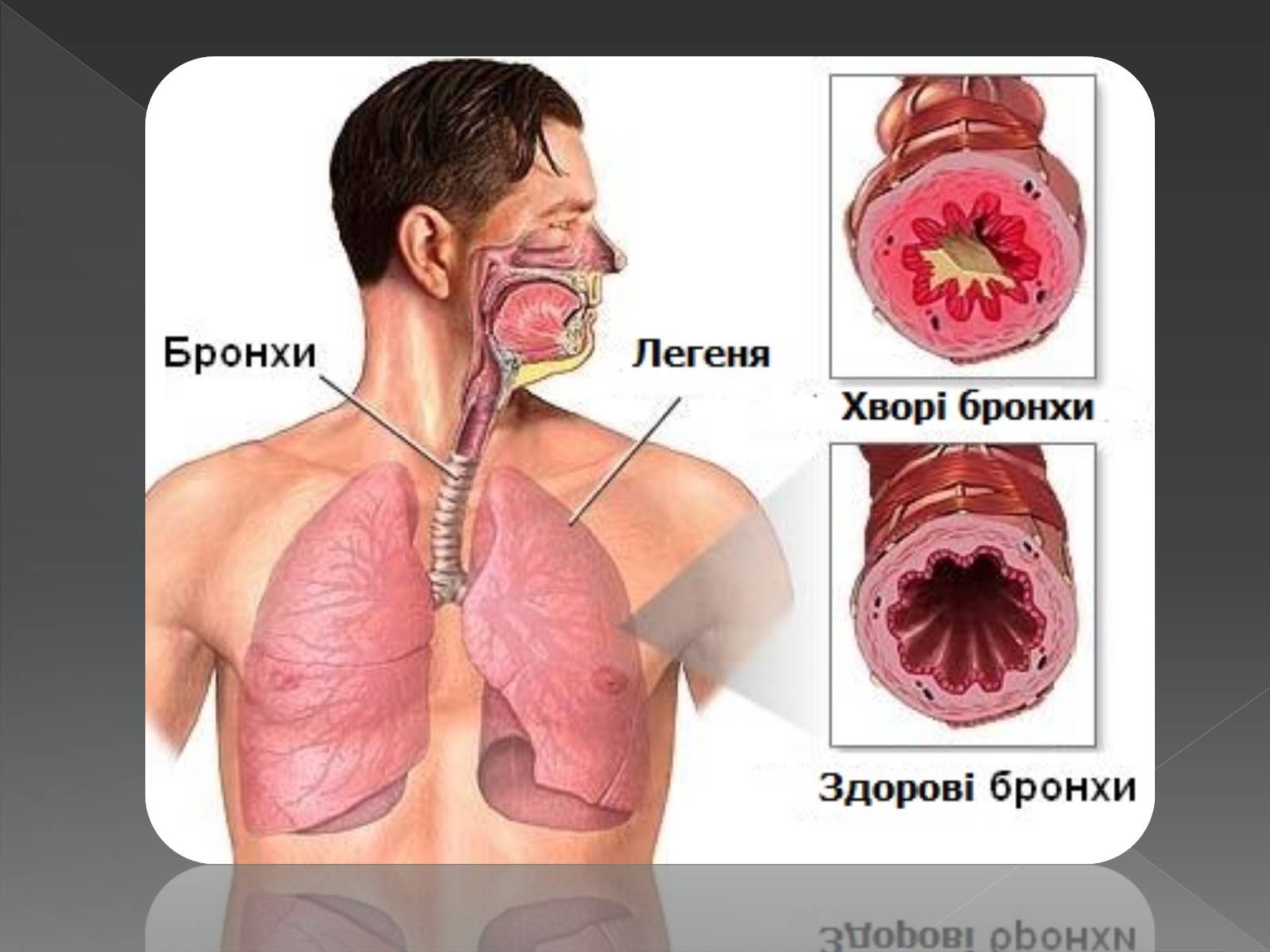 Презентація на тему «Види професійних захворювань органів дихання» - Слайд #9 Презентація на тему «Види професійних захворювань органів дихання» - Слайд #9
