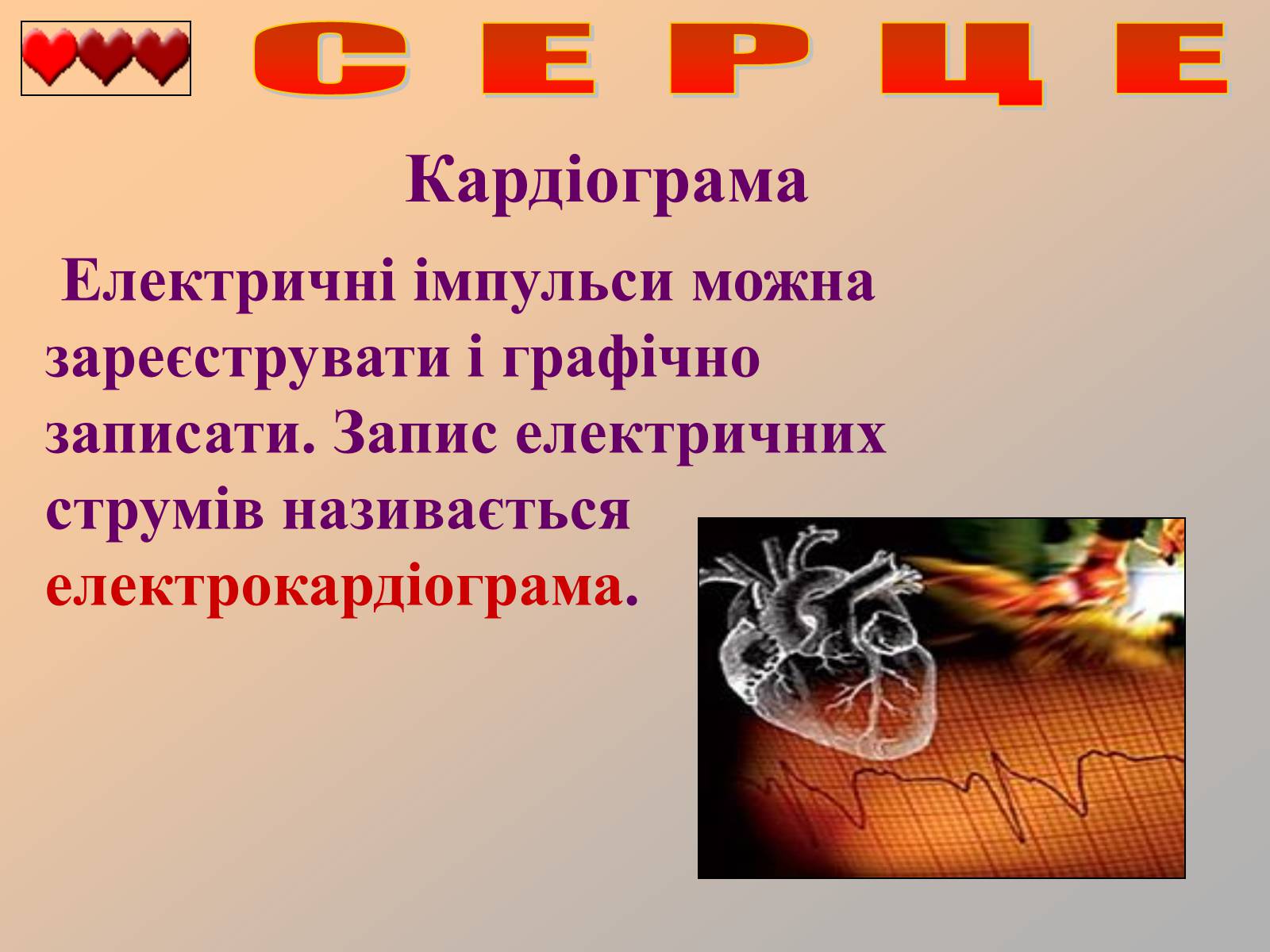 Презентація на тему «Серце людини» (варіант 1) - Слайд #32 Презентація на тему «Серце людини» (варіант 1) - Слайд #32