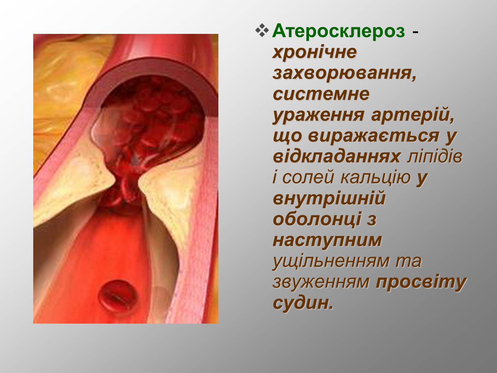 Презентація на тему «Серцево-судинна система людини» - Слайд #4 Презентація на тему «Серцево-судинна система людини» - Слайд #4