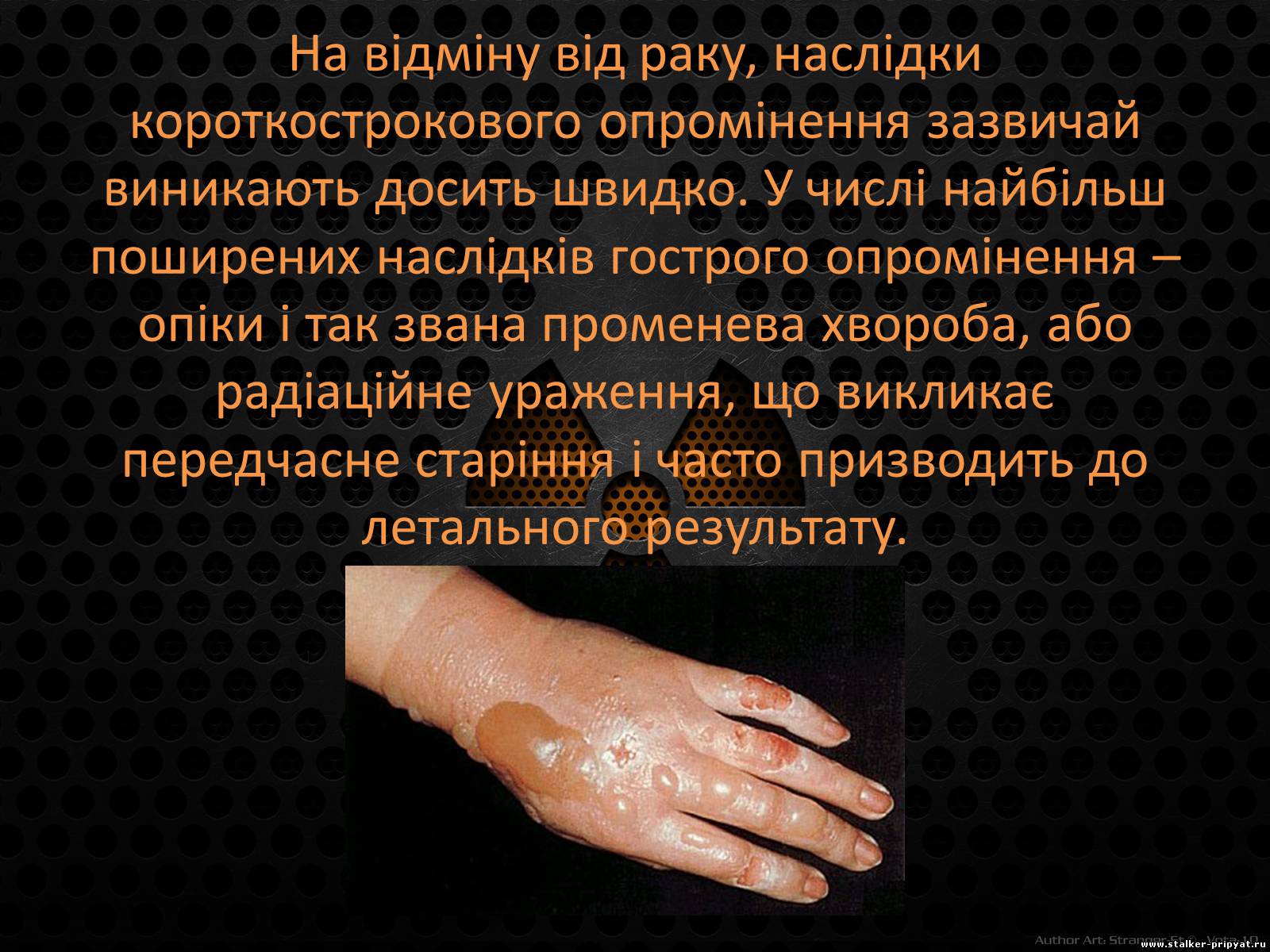 Презентація на тему «Наслідки впливу радіації на організм людини» - Слайд #11 Презентація на тему «Наслідки впливу радіації на організм людини» - Слайд #11