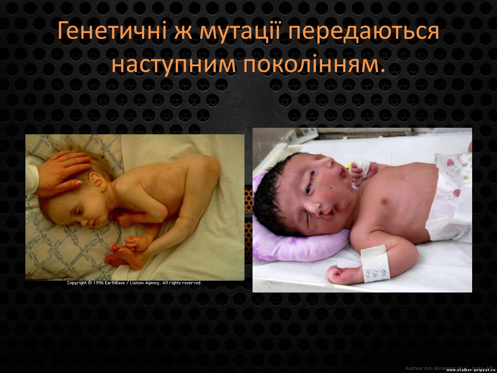 Презентація на тему «Наслідки впливу радіації на організм людини» - Слайд #9 Презентація на тему «Наслідки впливу радіації на організм людини» - Слайд #9